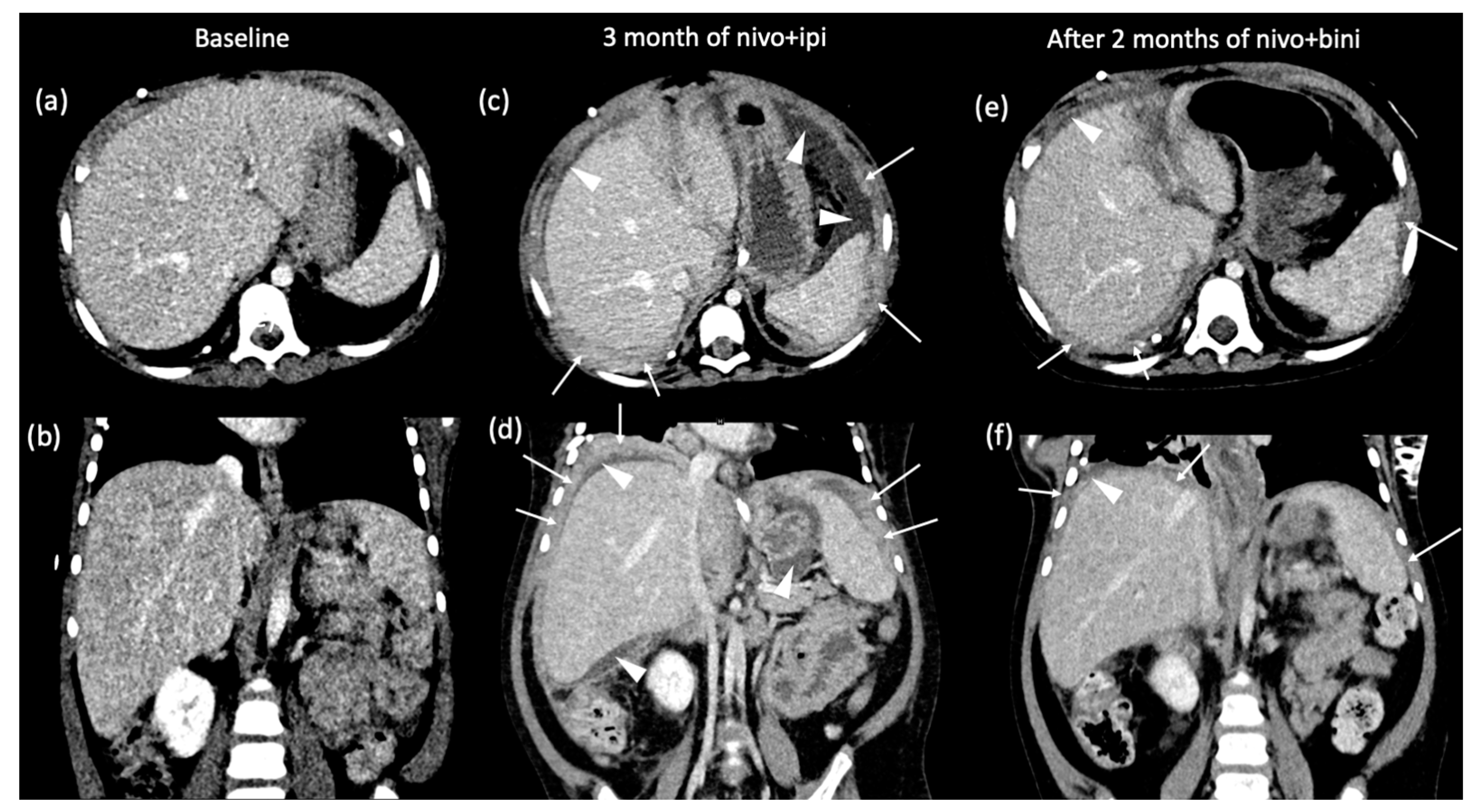Curroncol 31 00041 g003 Curroncol 31 00041 g003