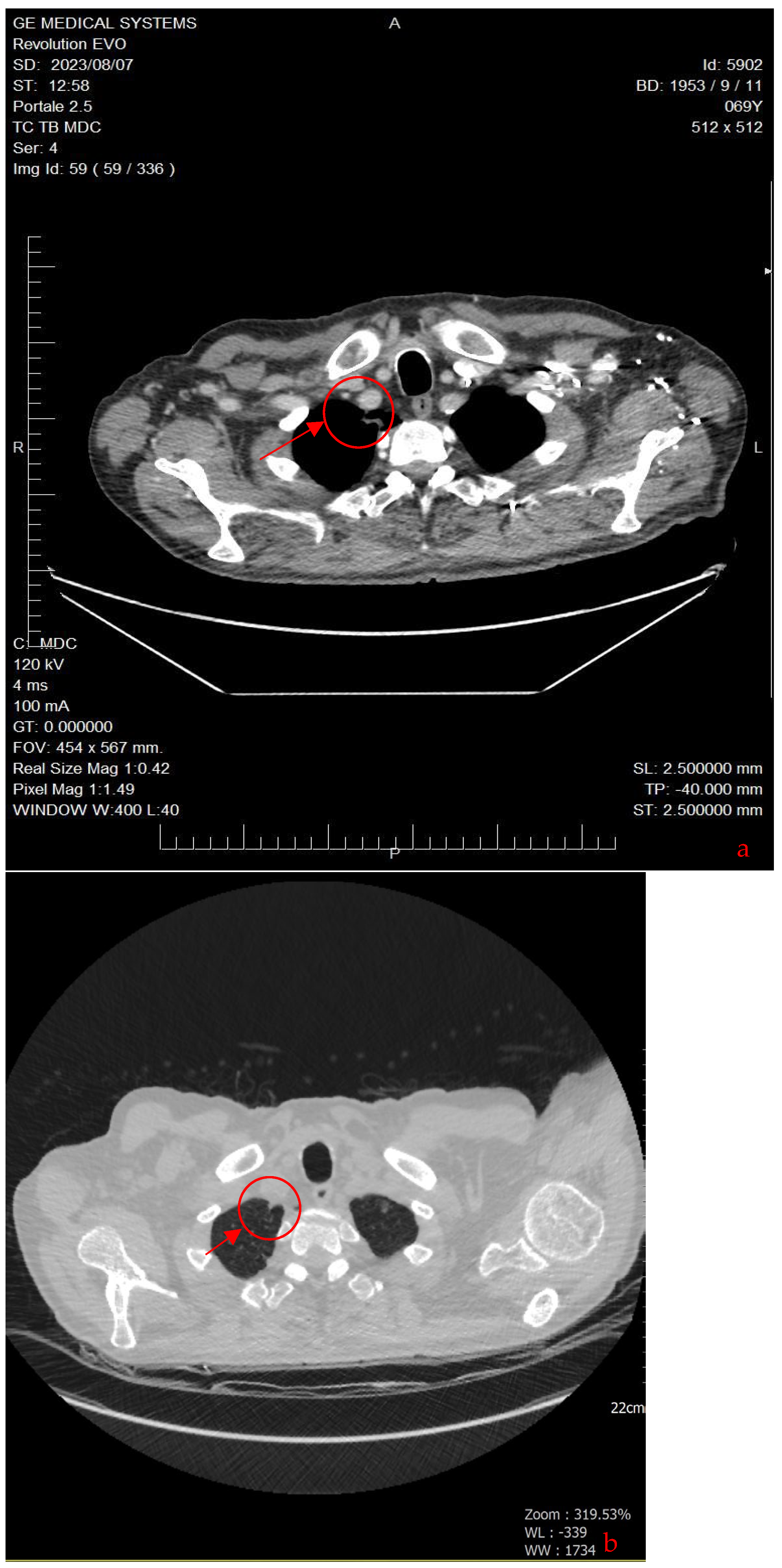 Curroncol 31 00053 g004