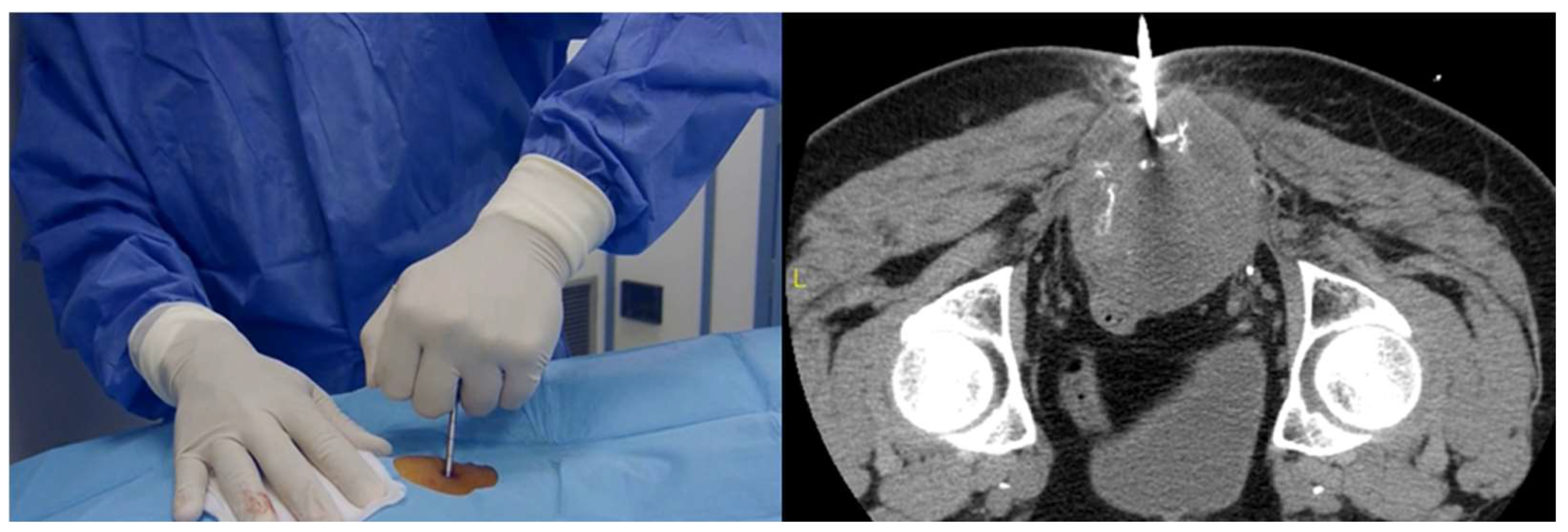 Curroncol 31 00067 g001 Curroncol 31 00067 g001