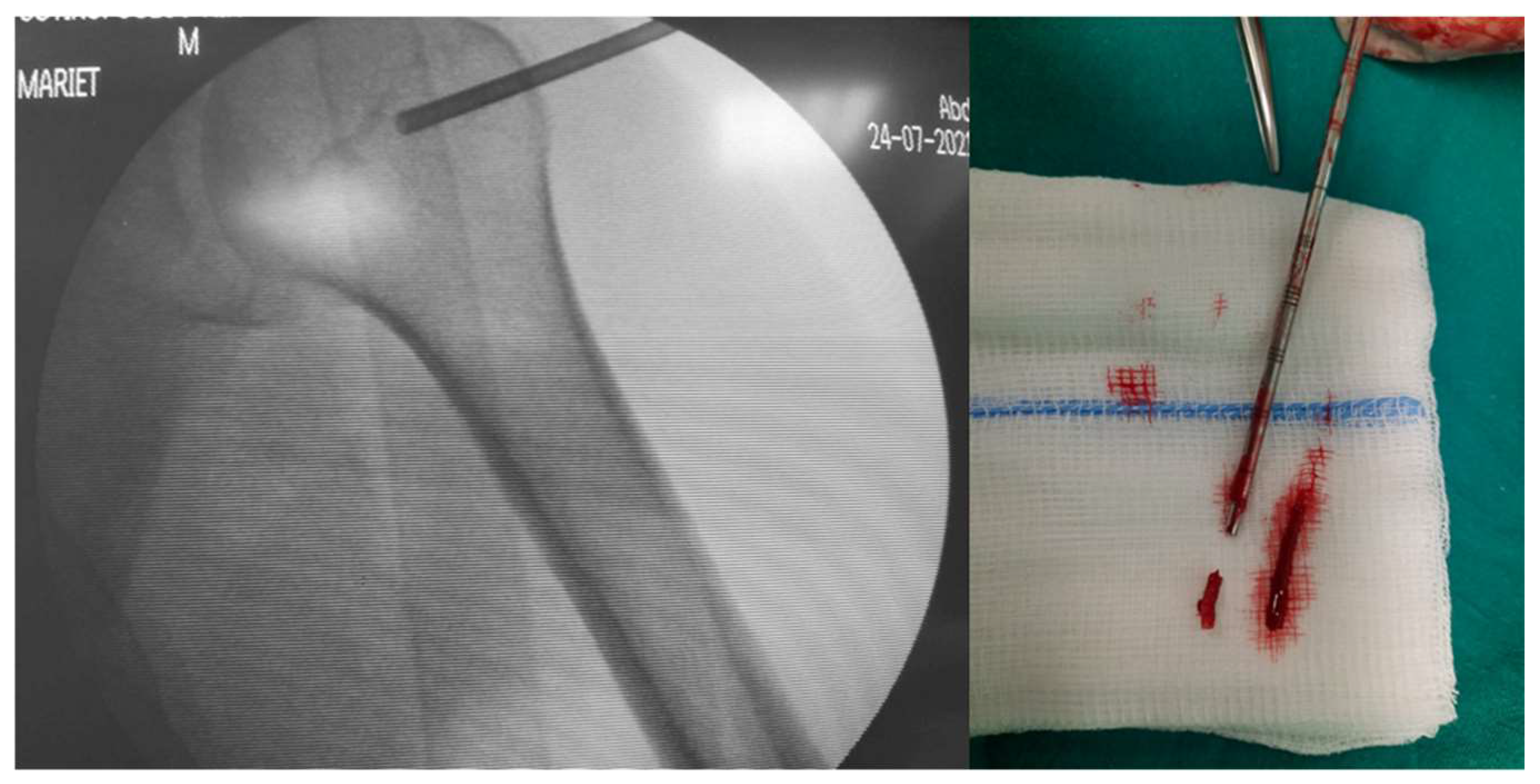 Curroncol 31 00067 g003 Curroncol 31 00067 g003