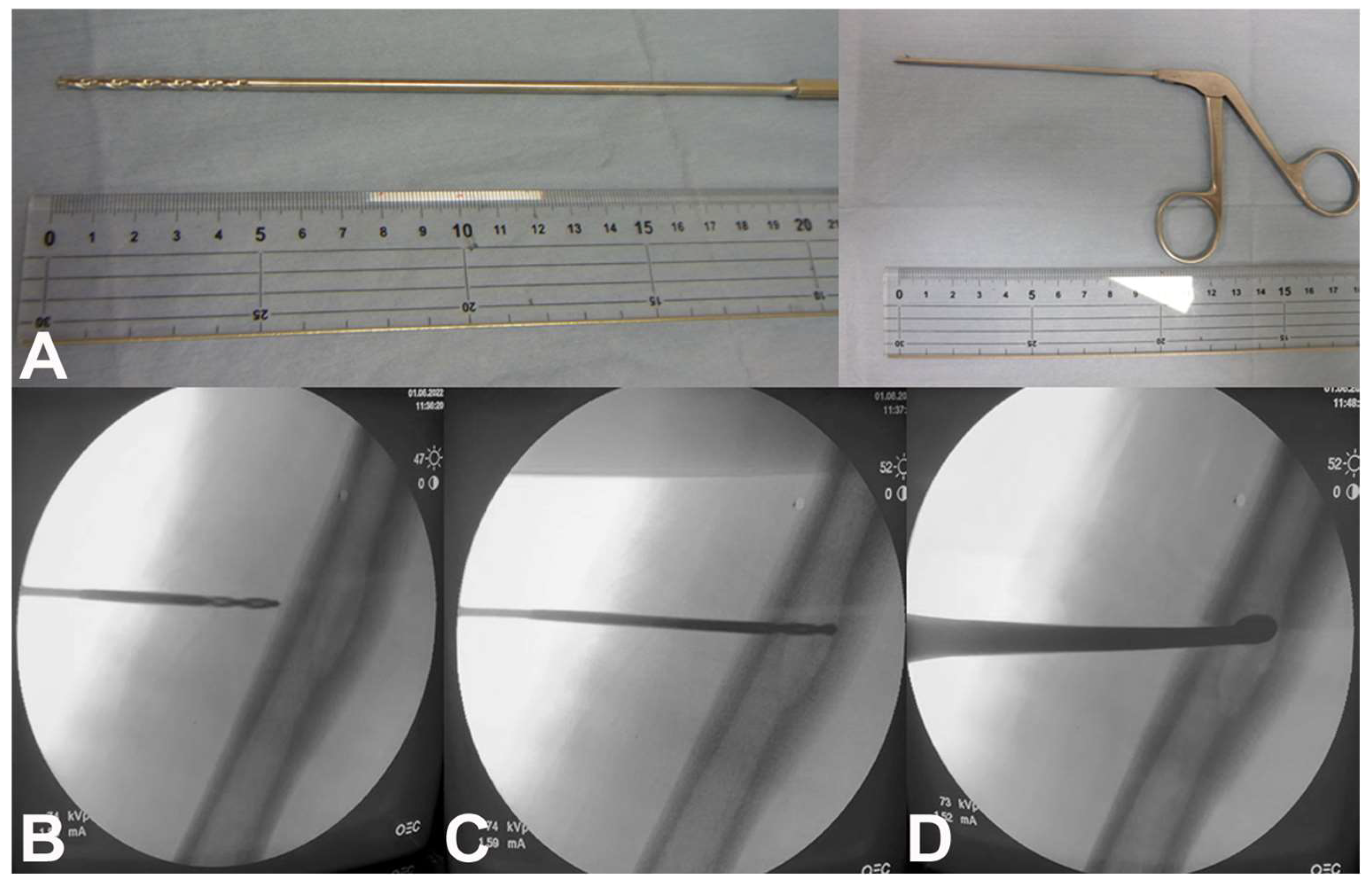 Curroncol 31 00067 g004 Curroncol 31 00067 g004