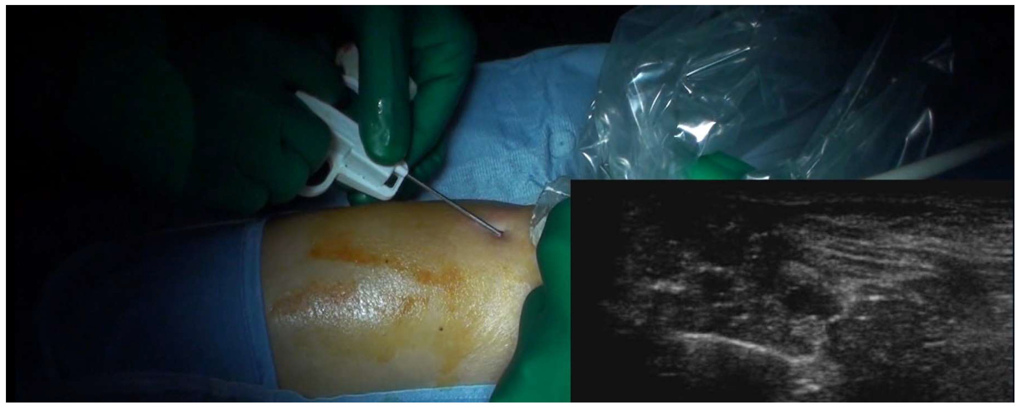 Curroncol 31 00067 g005 Curroncol 31 00067 g005