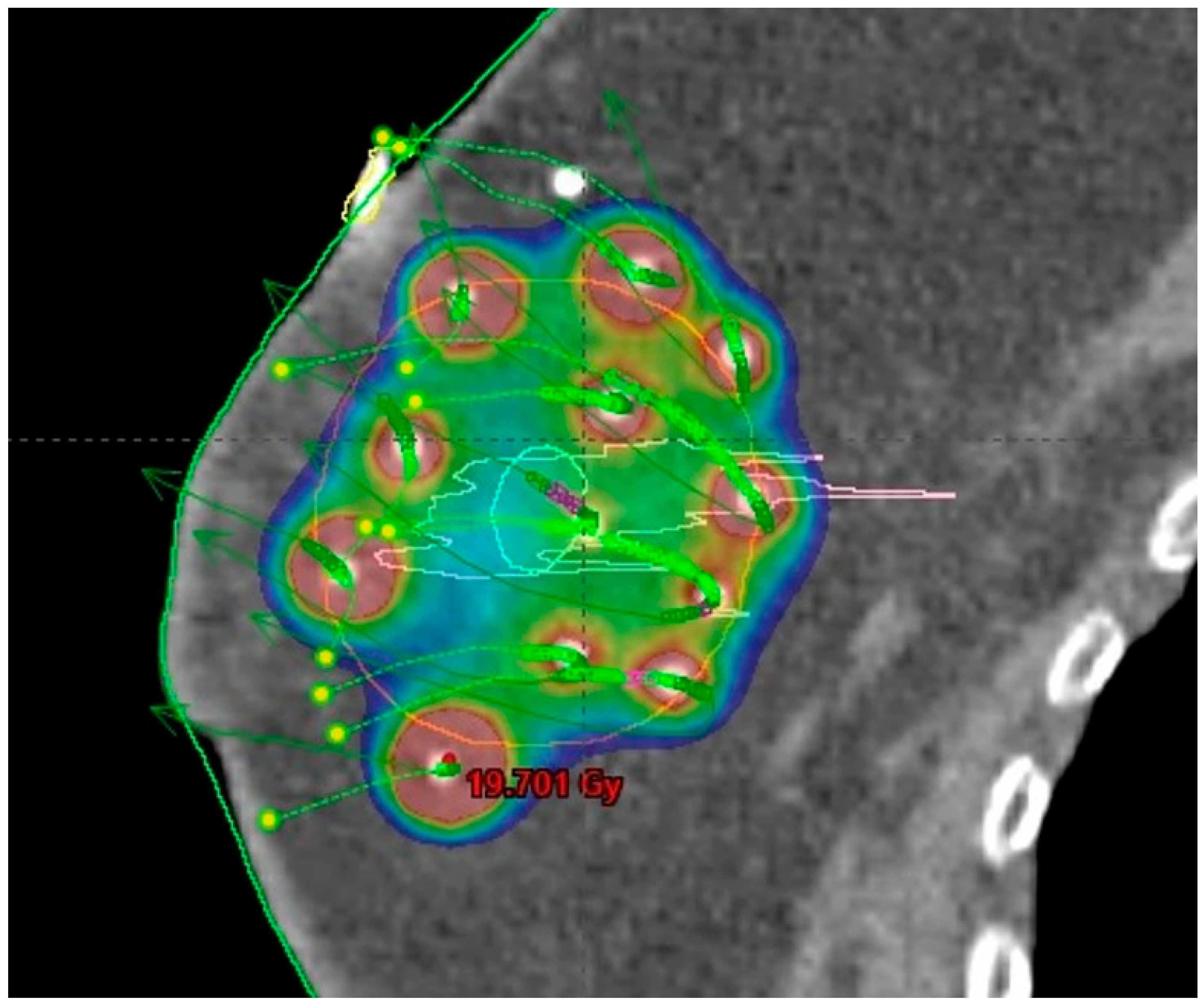 Curroncol 31 00090 g004