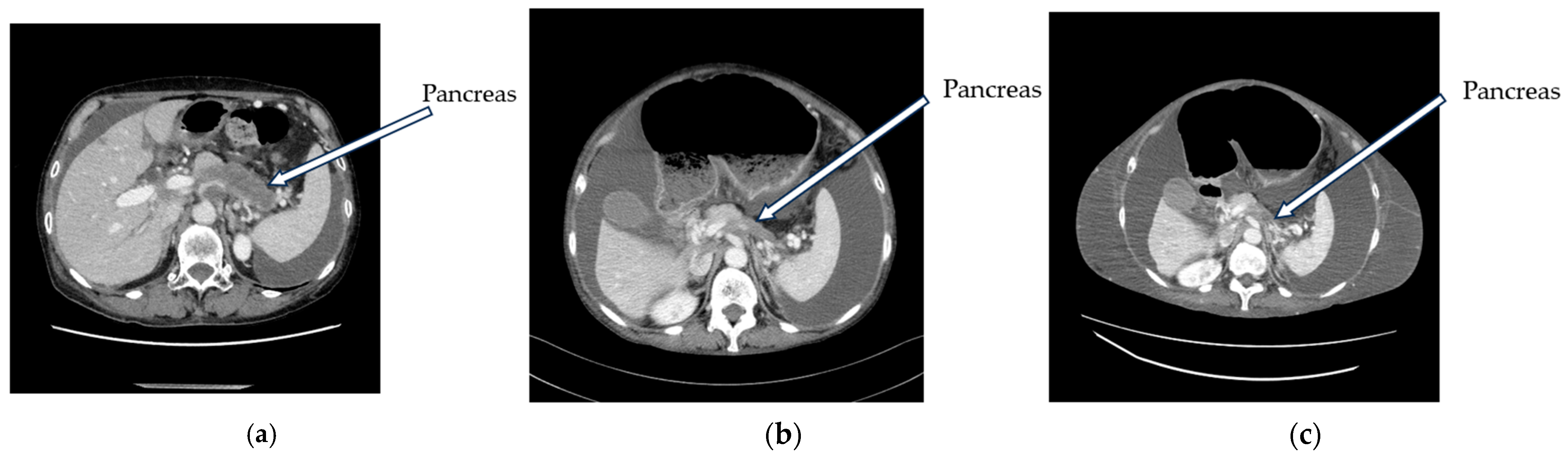 Curroncol 31 00112 g001 Curroncol 31 00112 g001