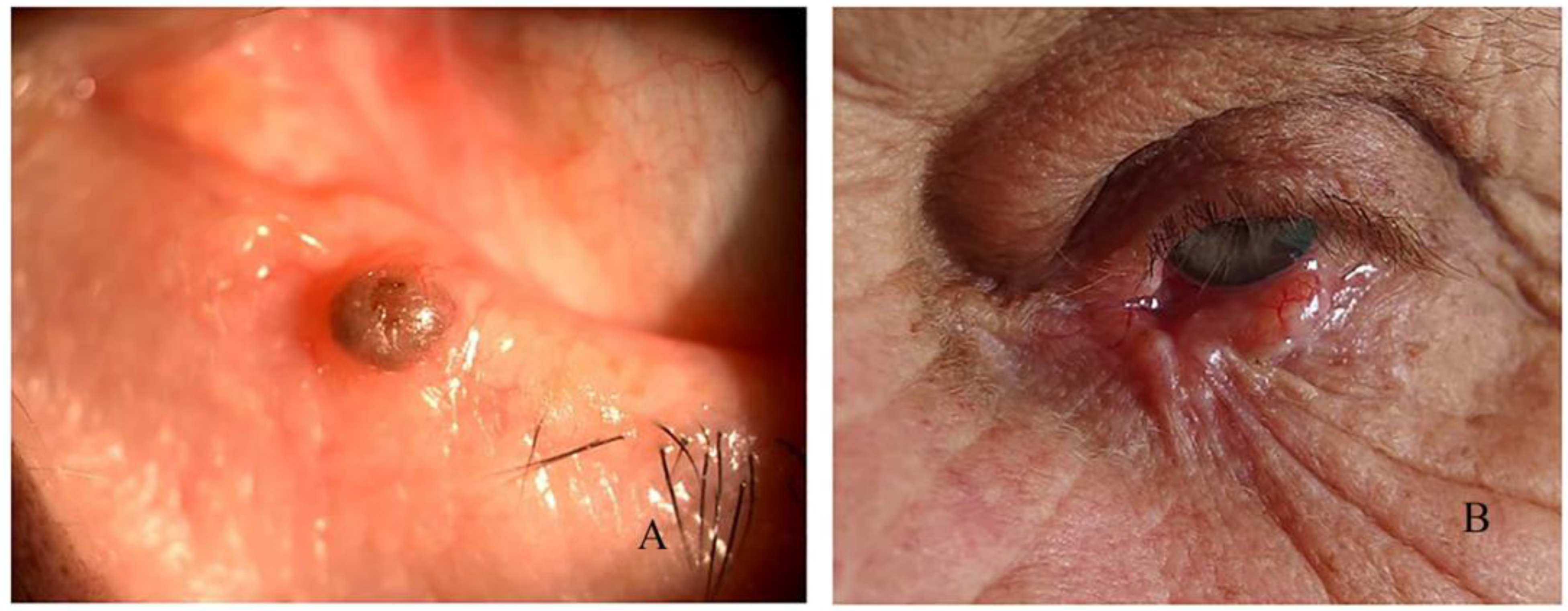 Curroncol 31 00130 g004