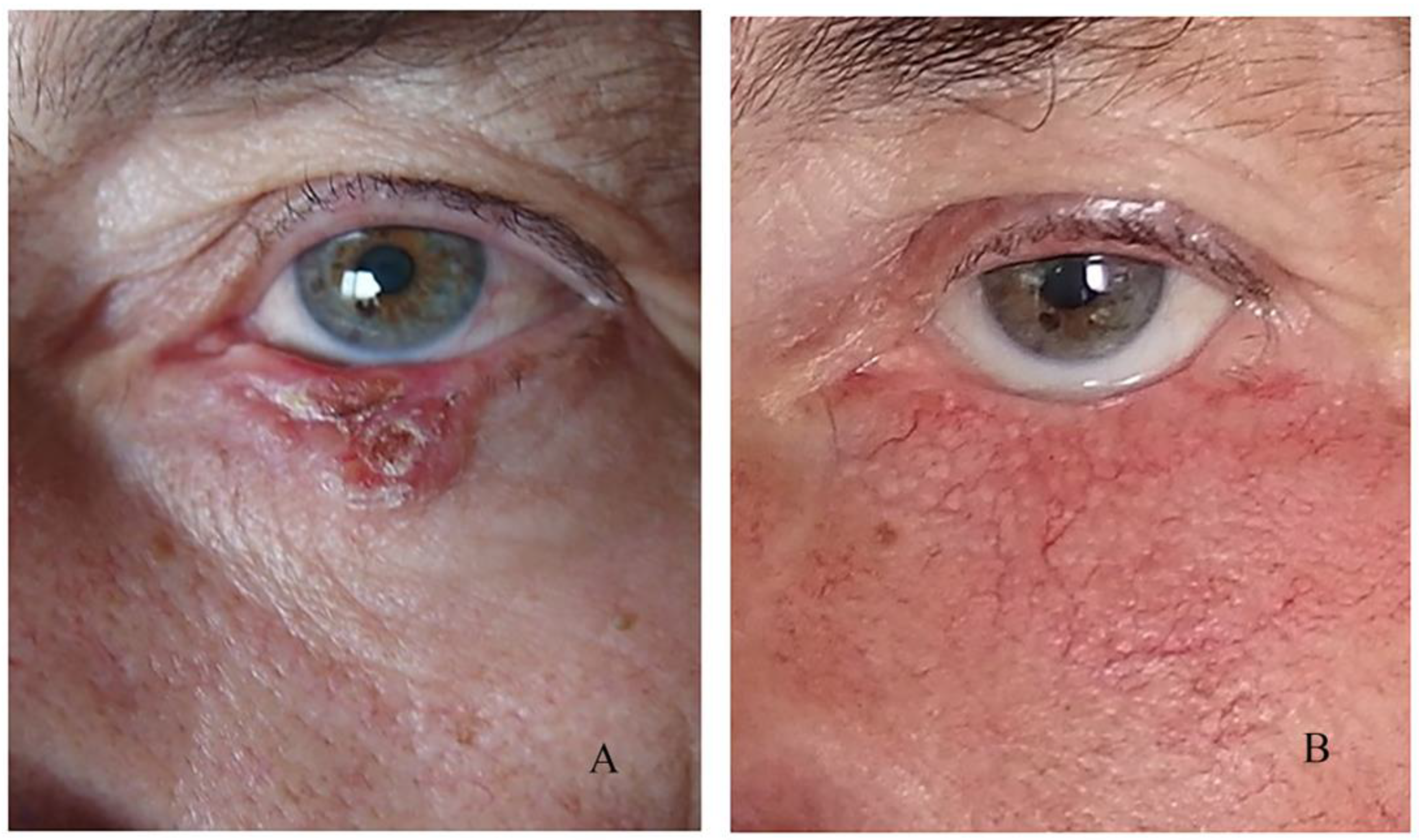 Curroncol 31 00130 g007