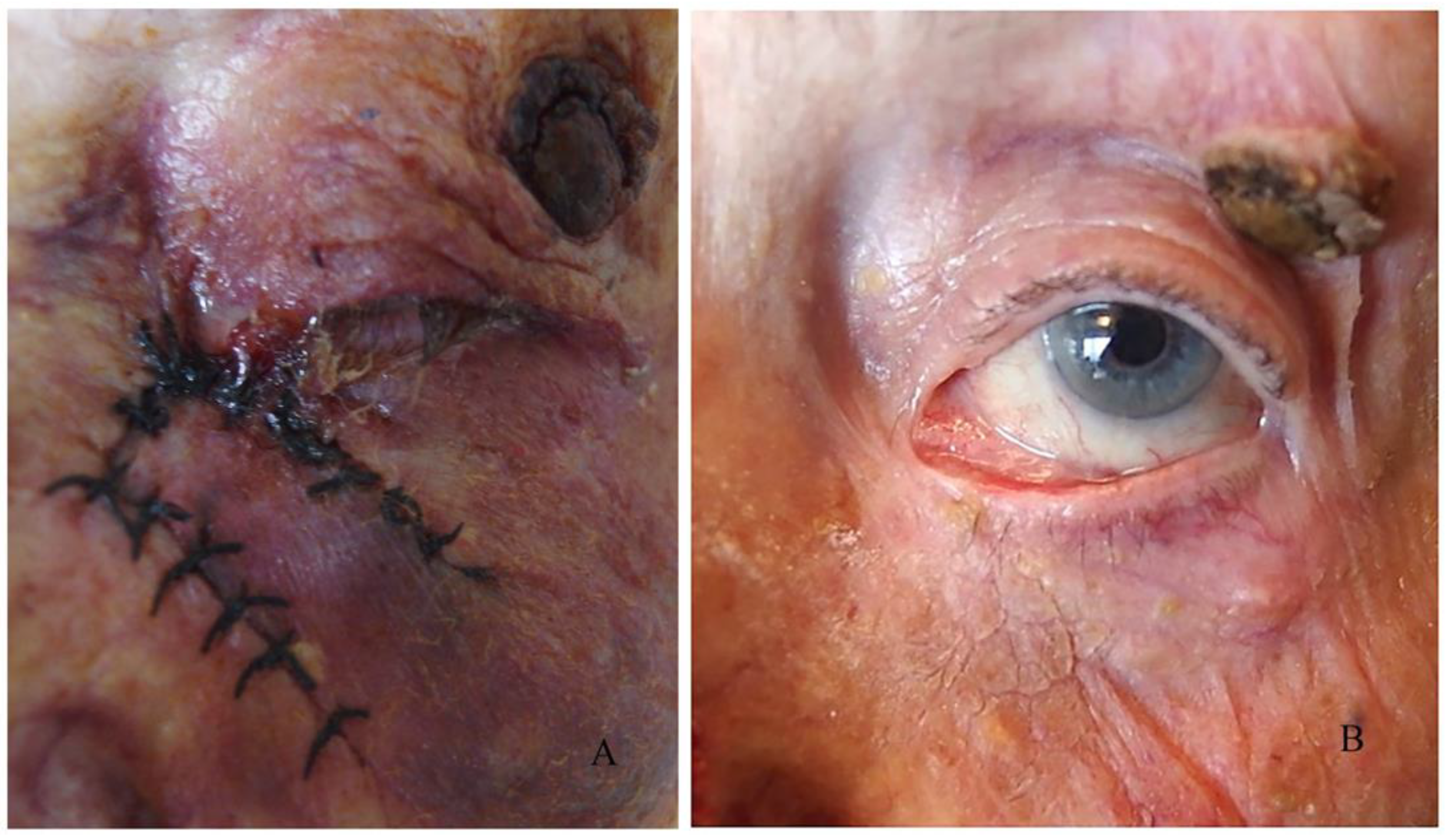 Curroncol 31 00130 g008