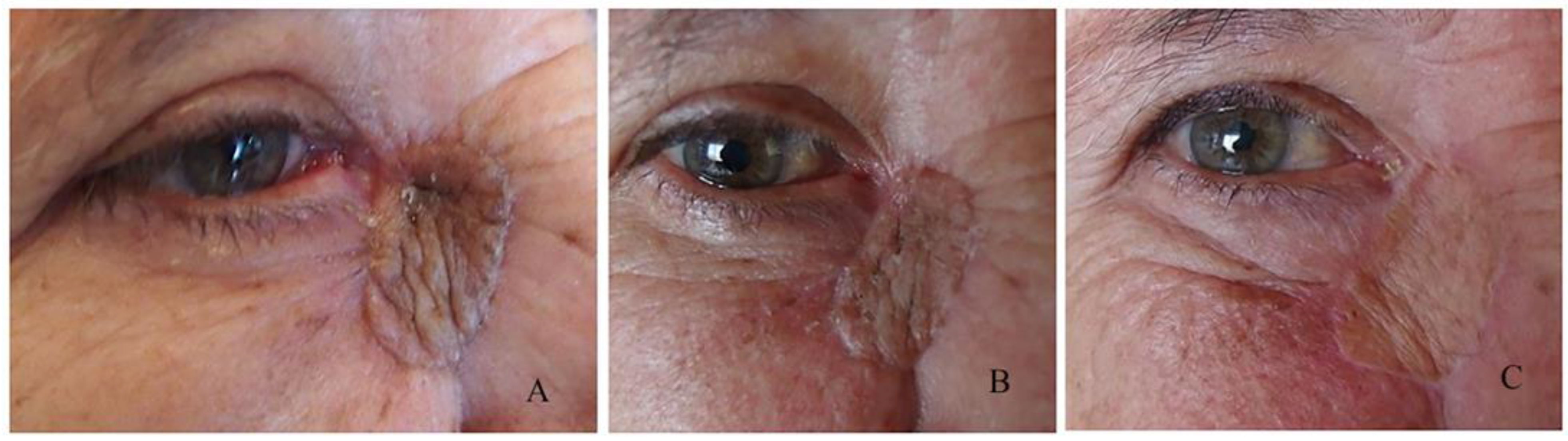 Curroncol 31 00130 g009