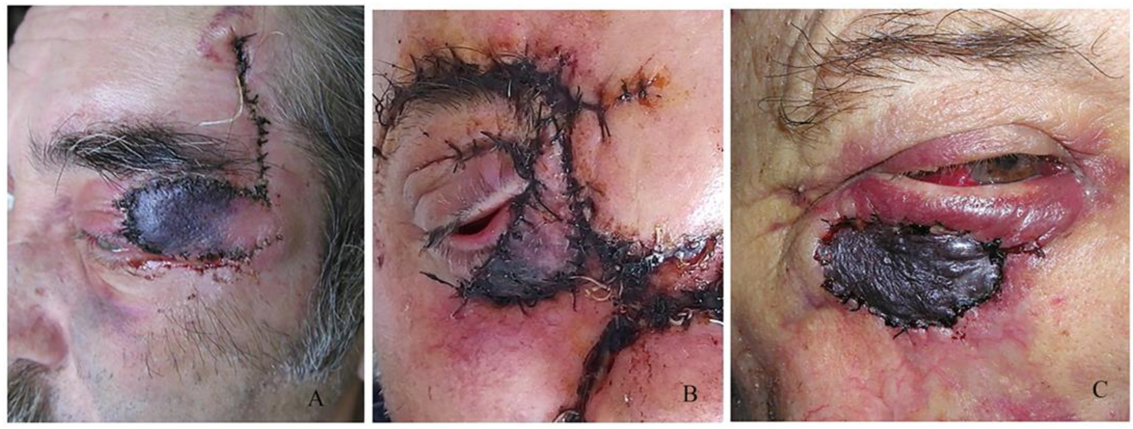 Curroncol 31 00130 g011