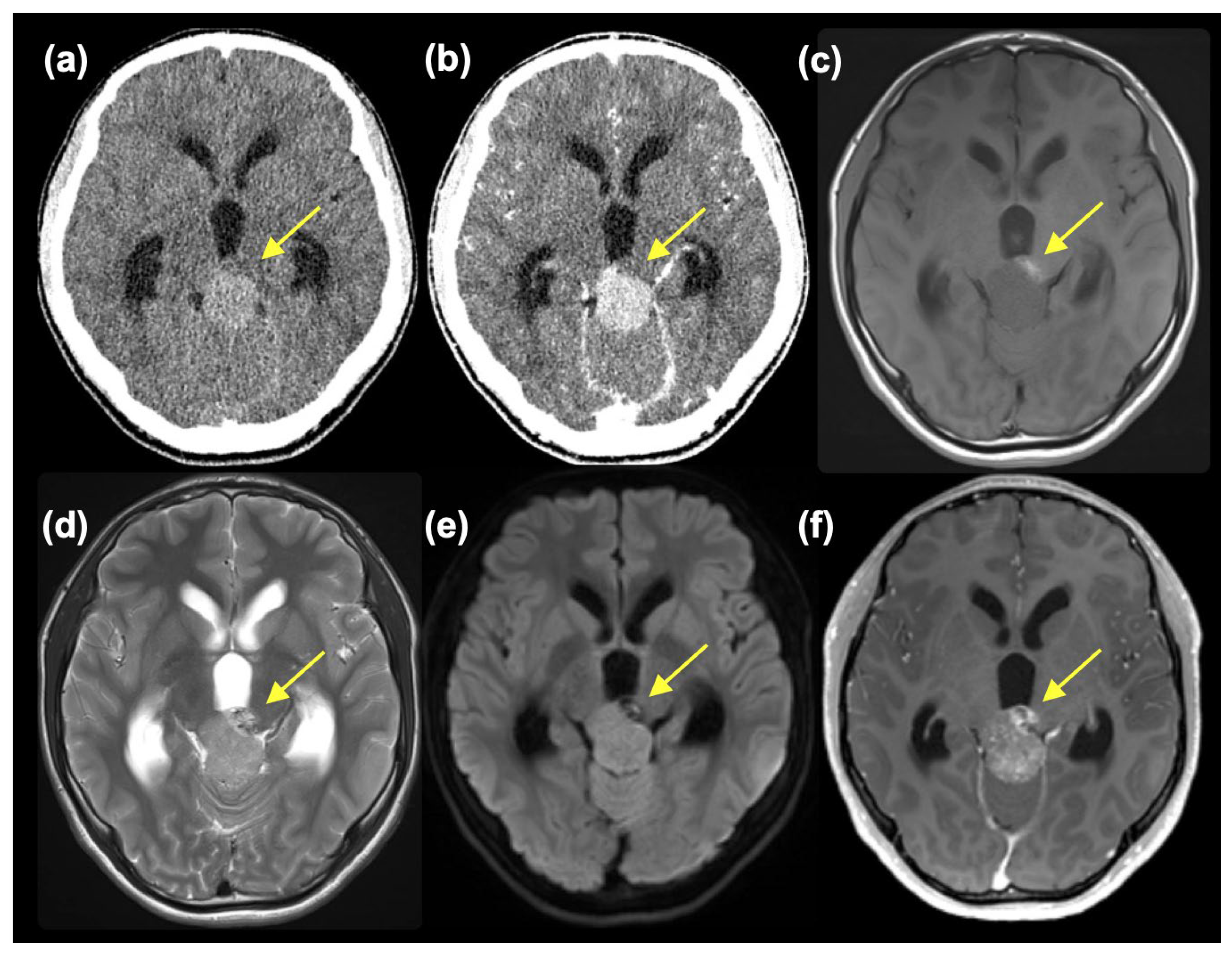 Curroncol 31 00138 g001