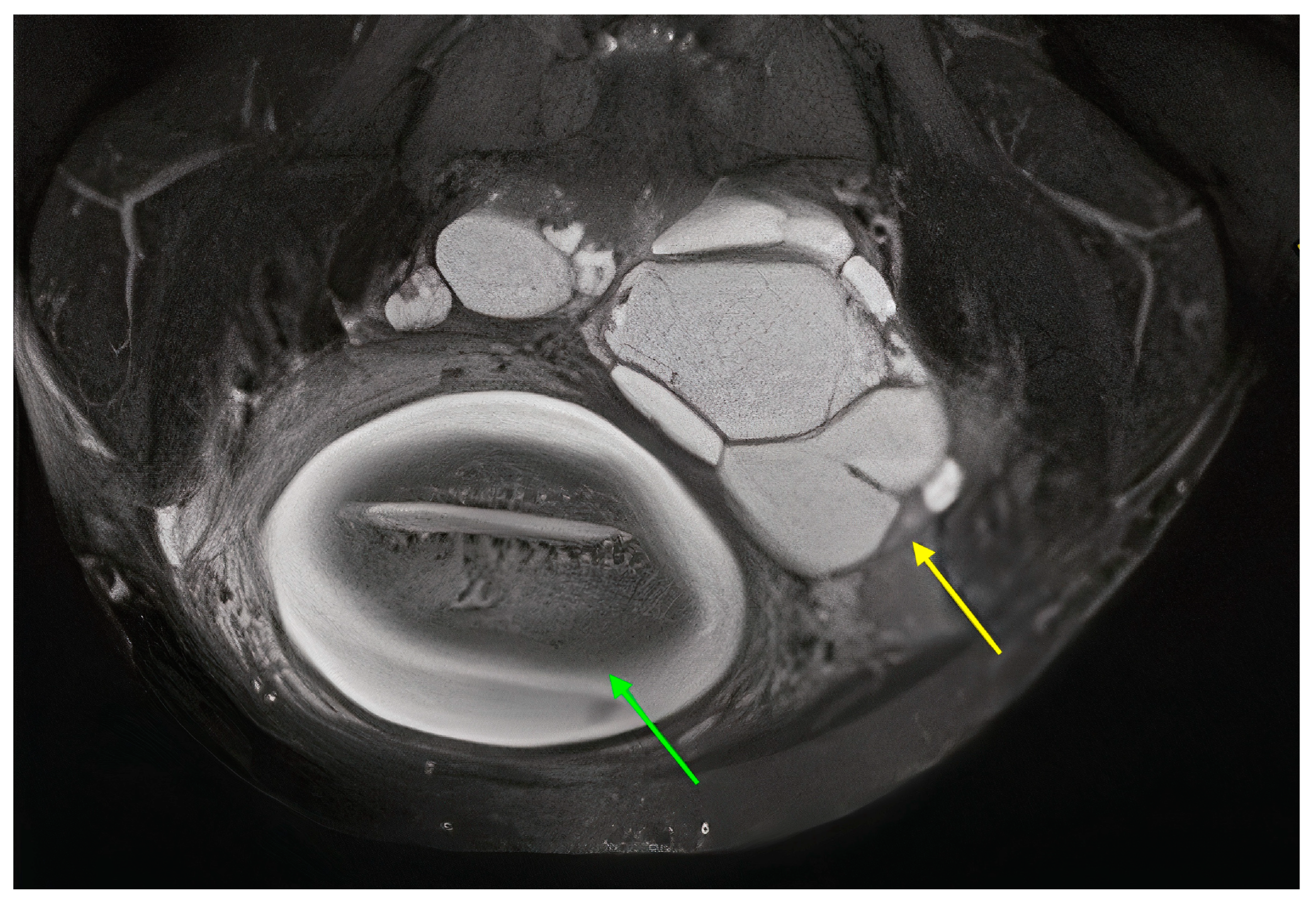 Curroncol 31 00144 g002