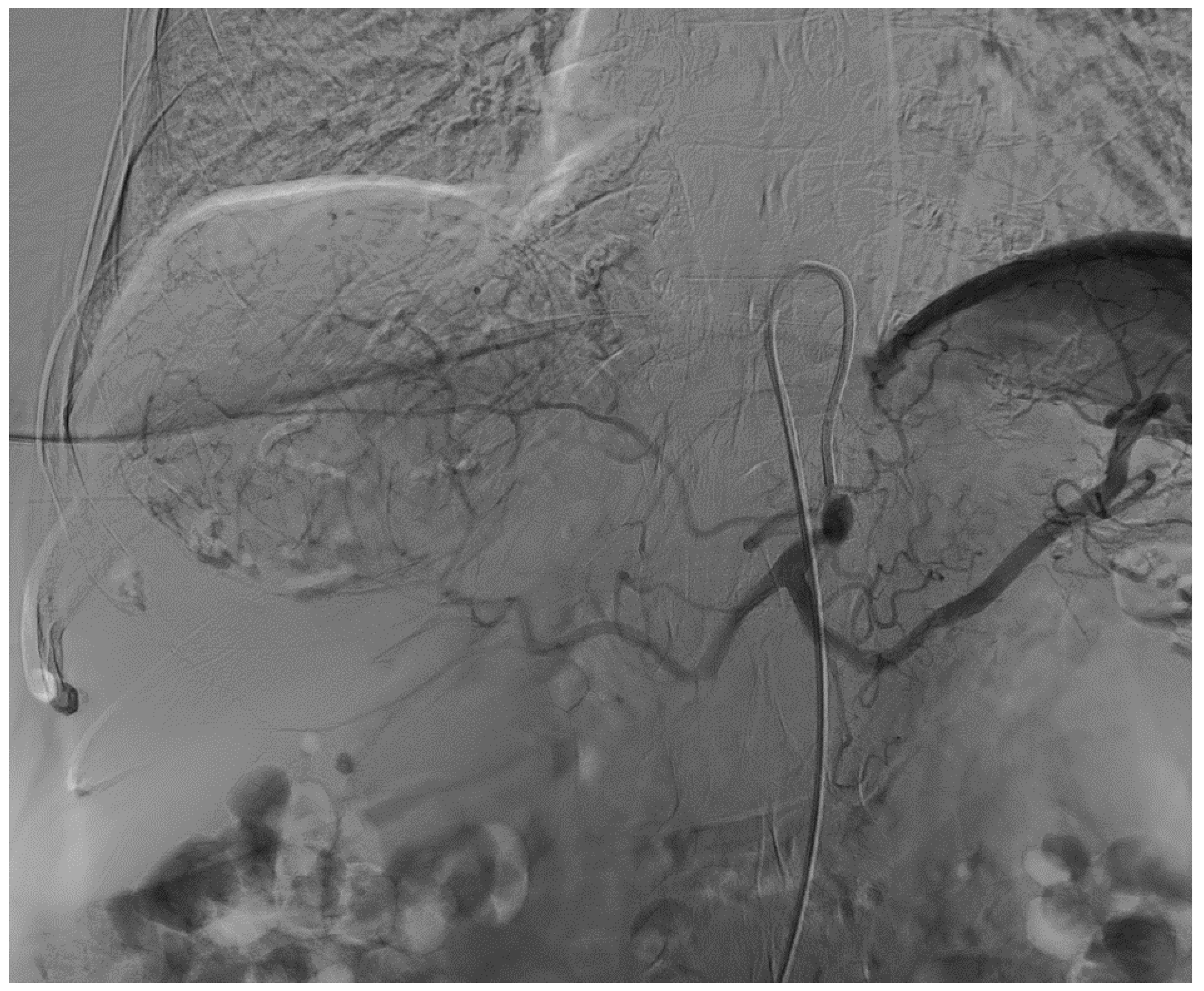 Curroncol 31 00147 g002 Curroncol 31 00147 g002