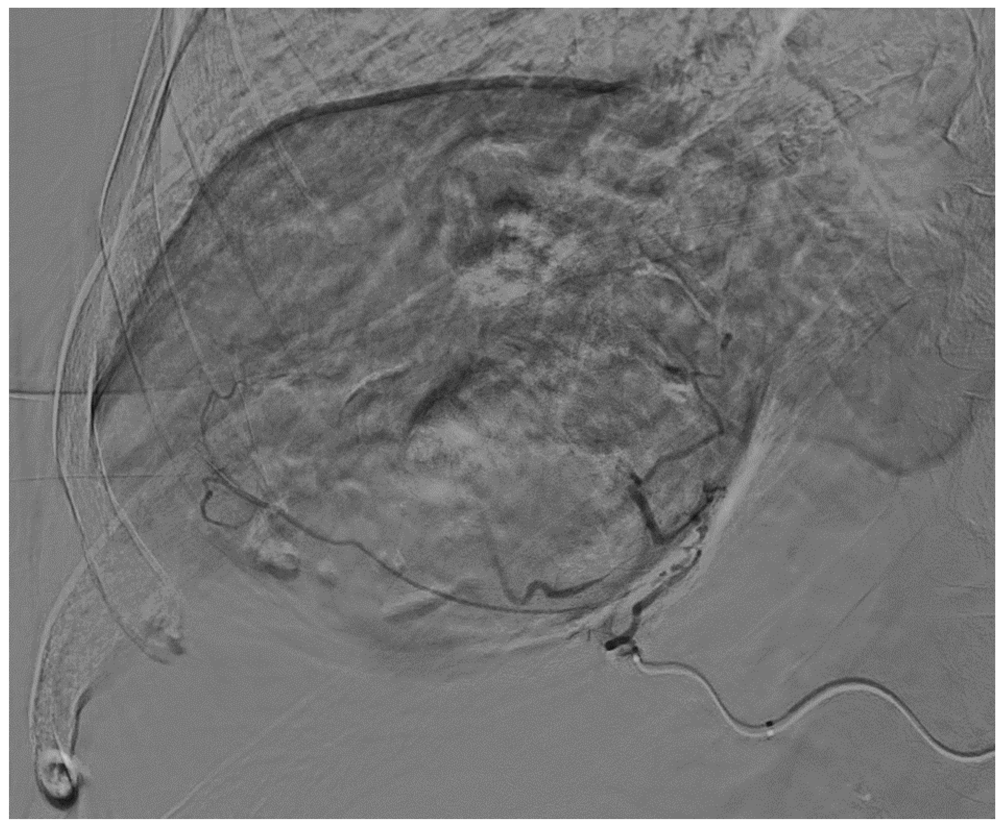 Curroncol 31 00147 g003 Curroncol 31 00147 g003