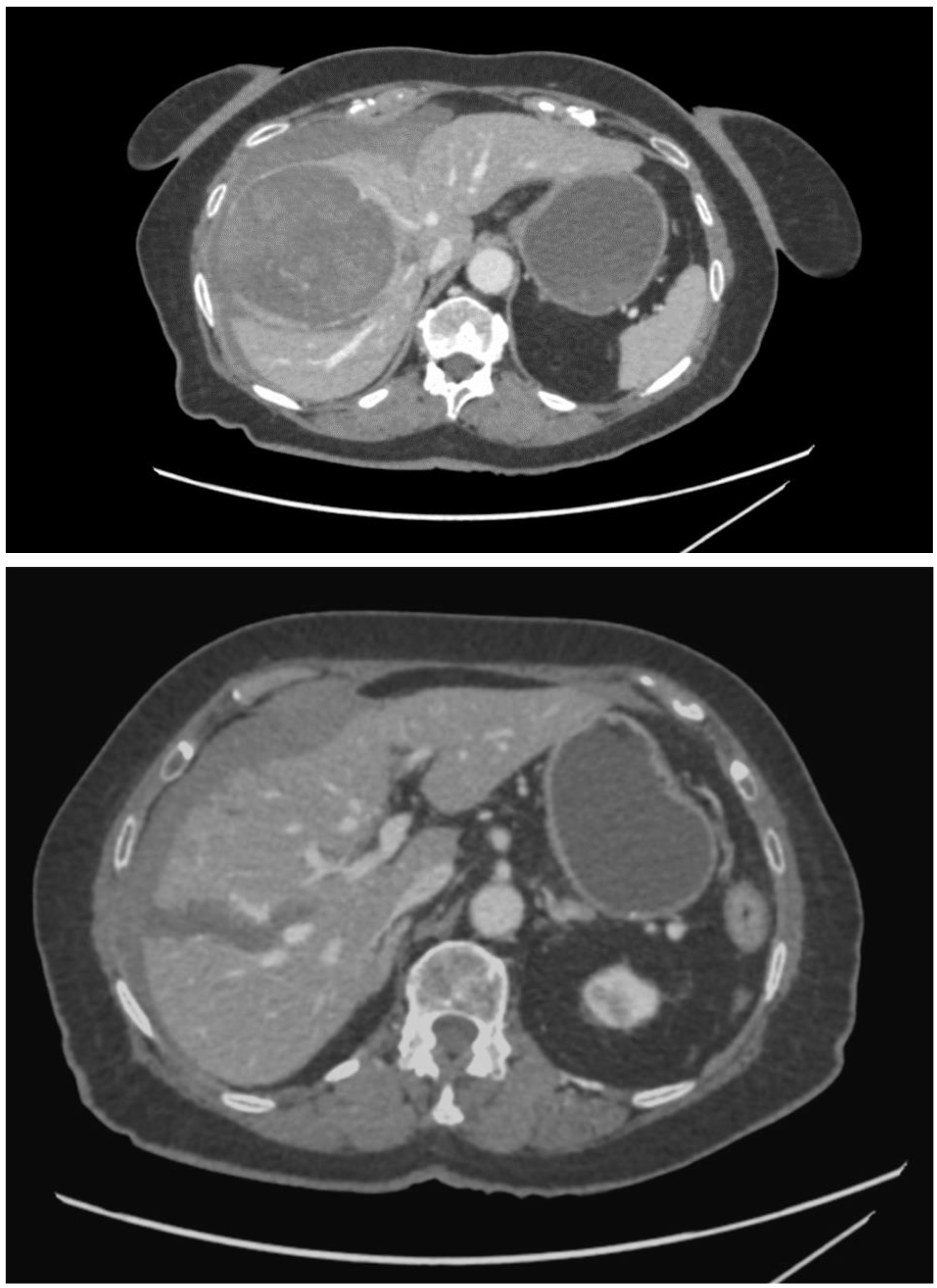 Curroncol 31 00147 g004a Curroncol 31 00147 g004a