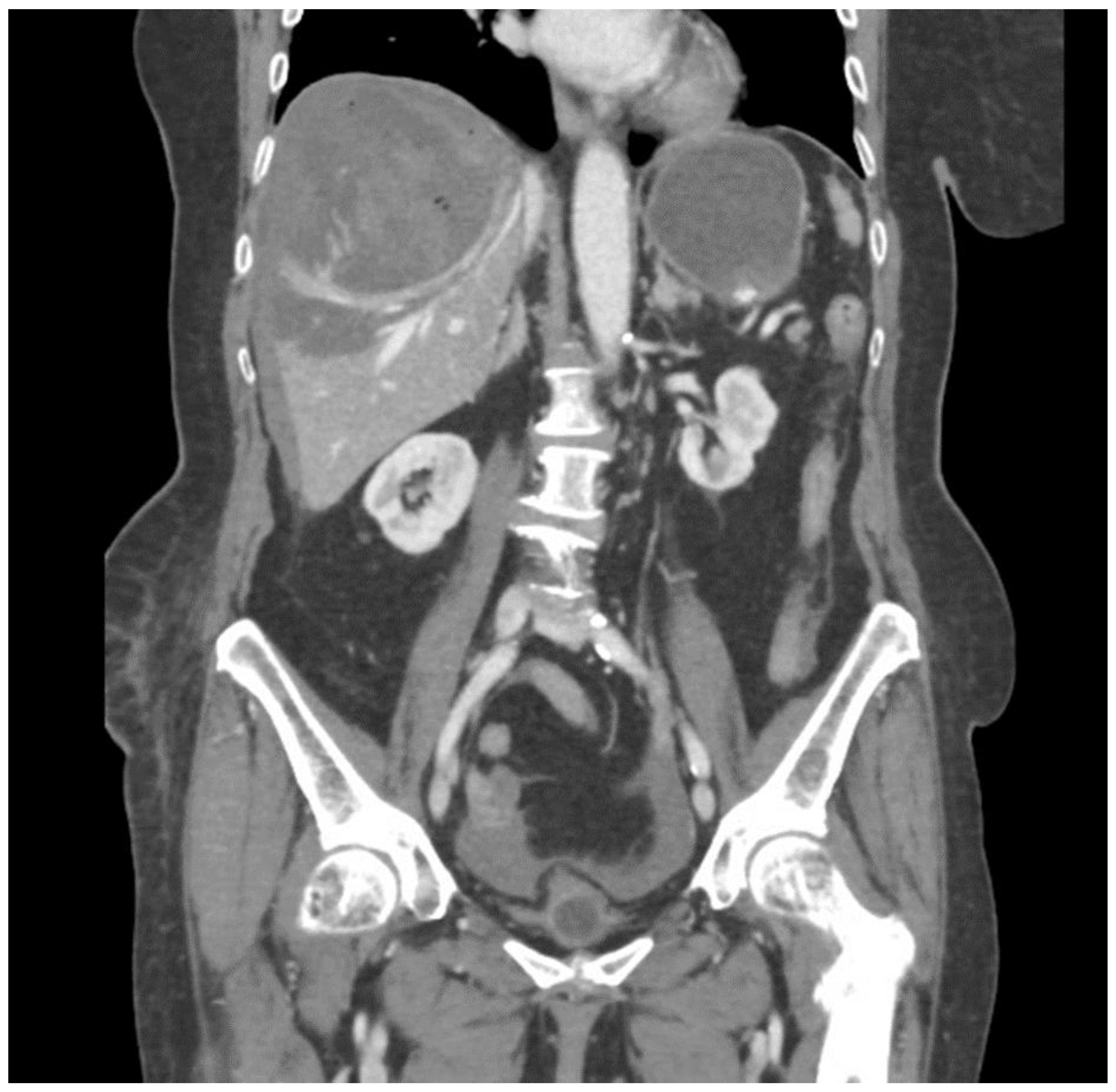 Curroncol 31 00147 g004b Curroncol 31 00147 g004b