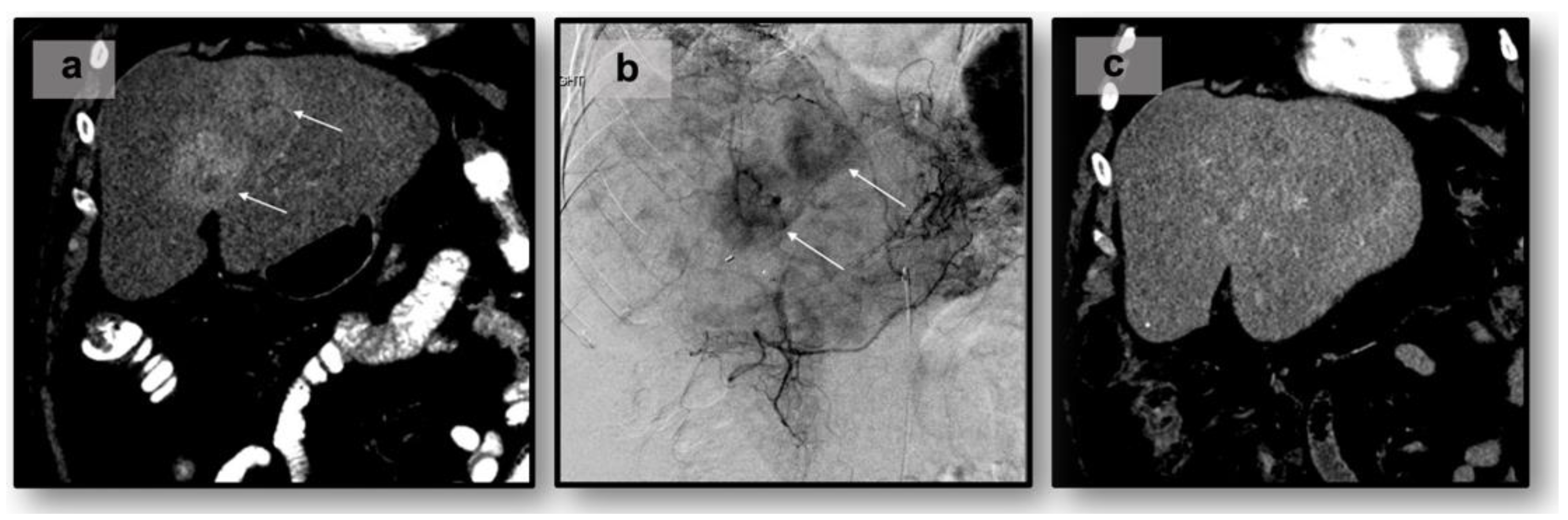 Curroncol 31 00154 g001