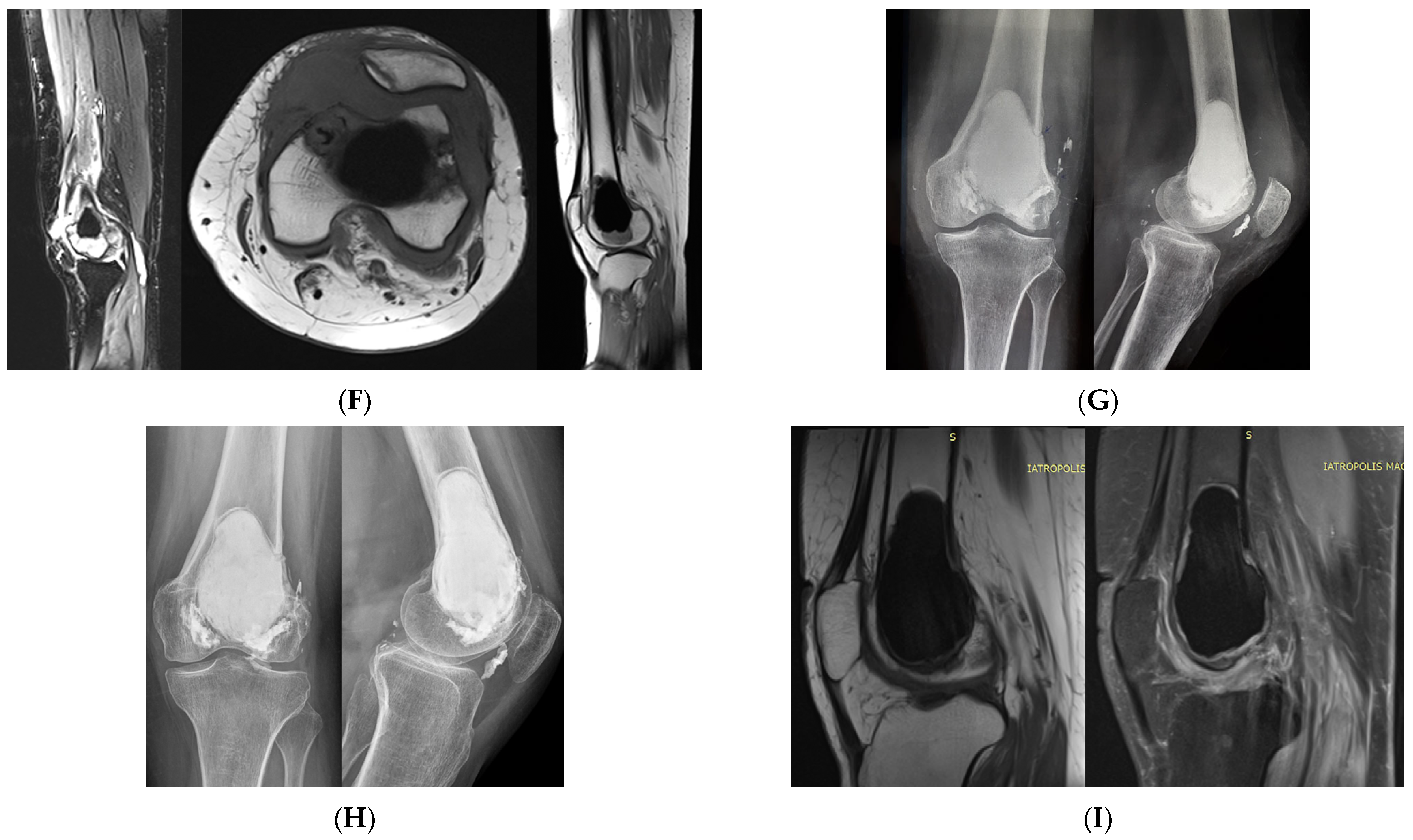 Curroncol 31 00157 g002b Curroncol 31 00157 g002b