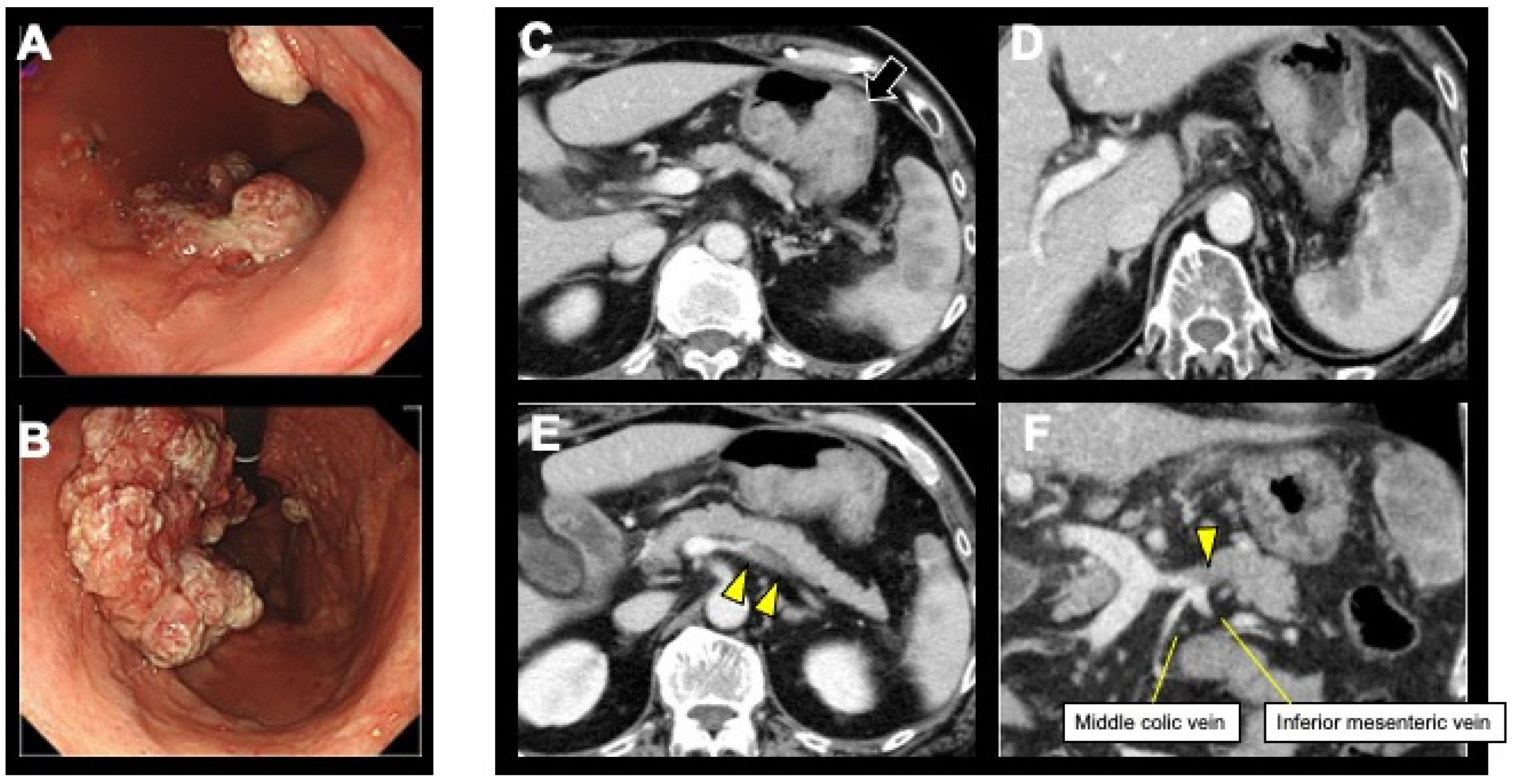 Curroncol 31 00201 g002