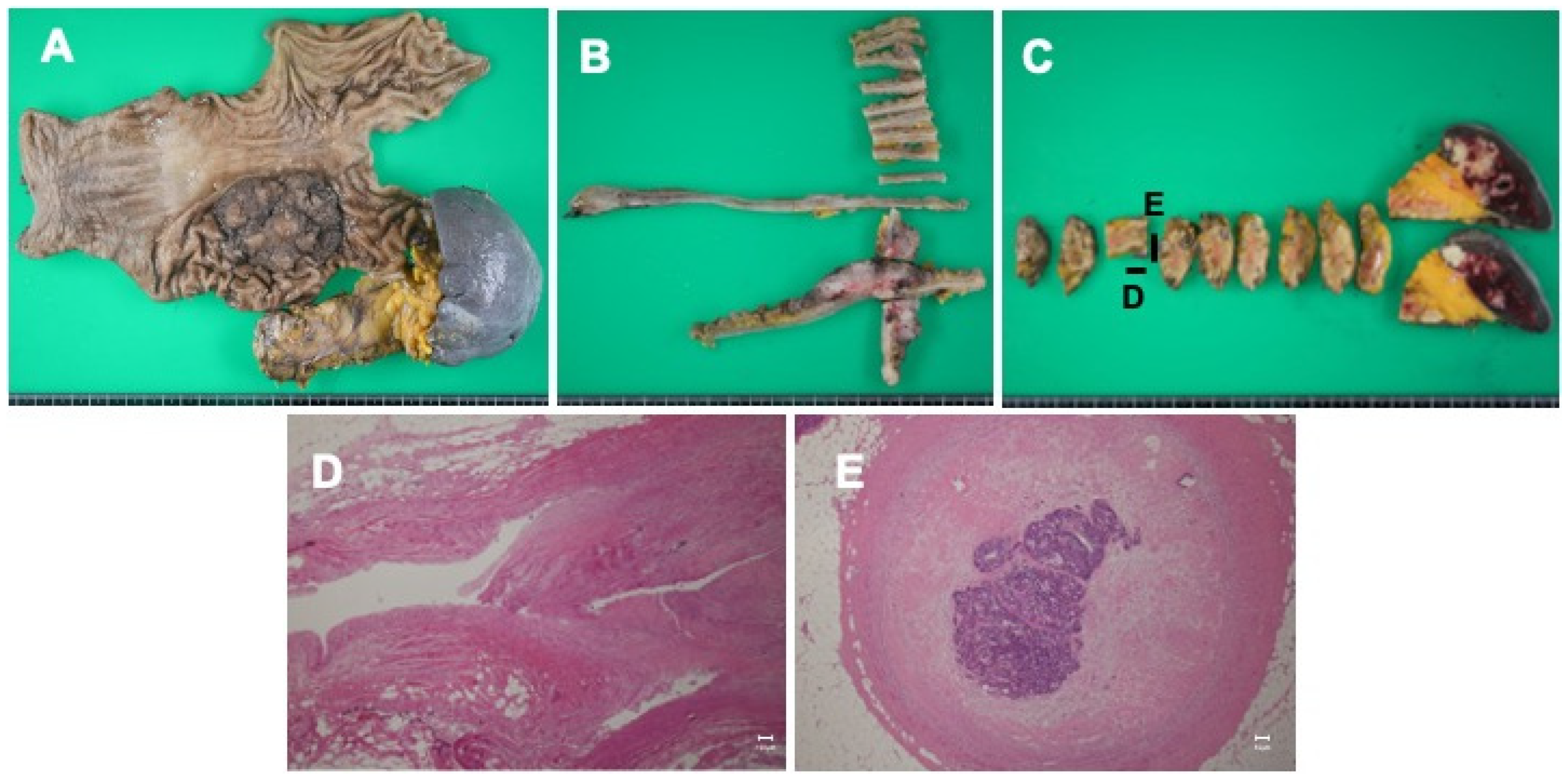 Curroncol 31 00201 g004