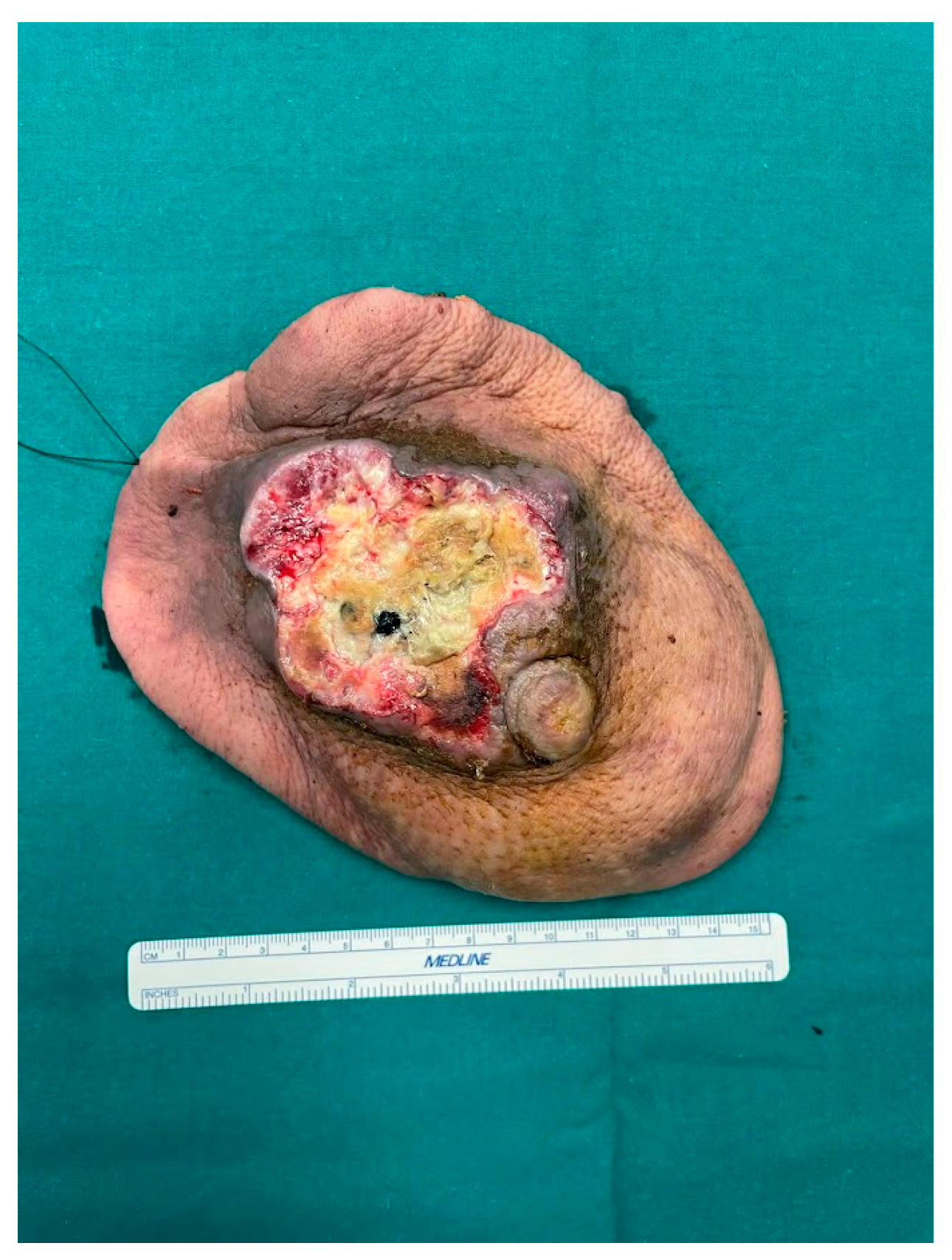 Curroncol 31 00217 g002