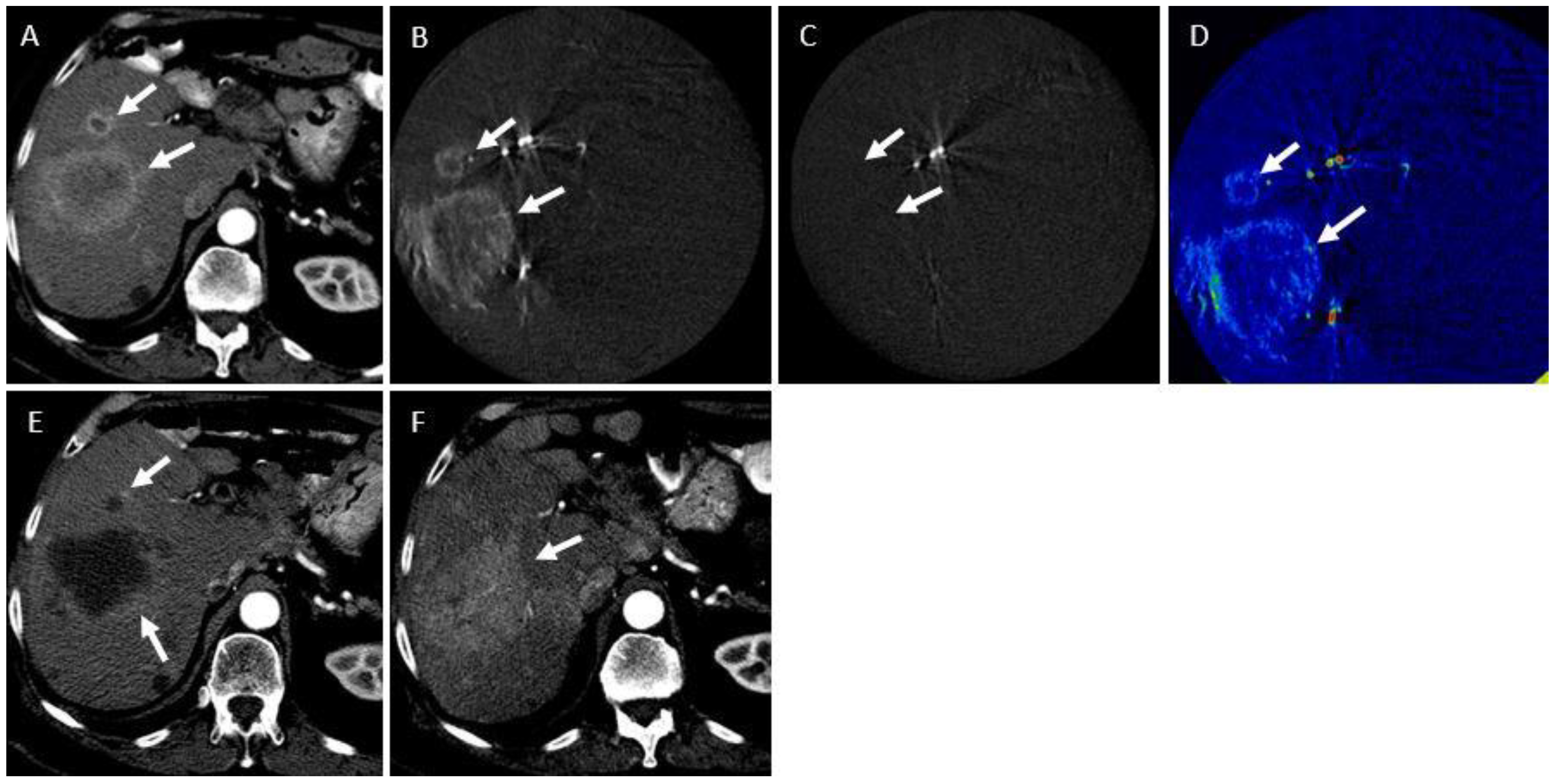 Curroncol 31 00231 g004