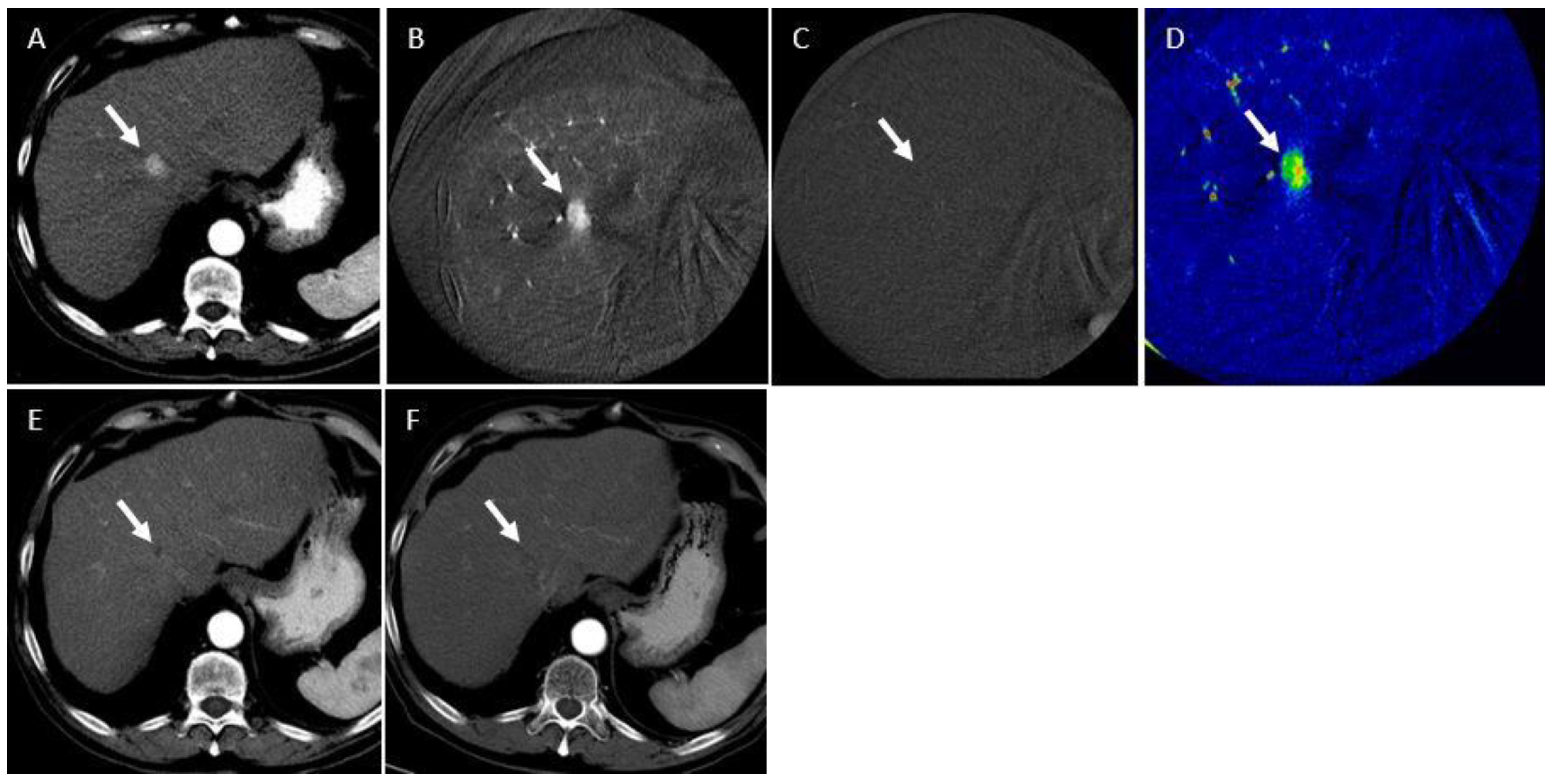 Curroncol 31 00231 g005