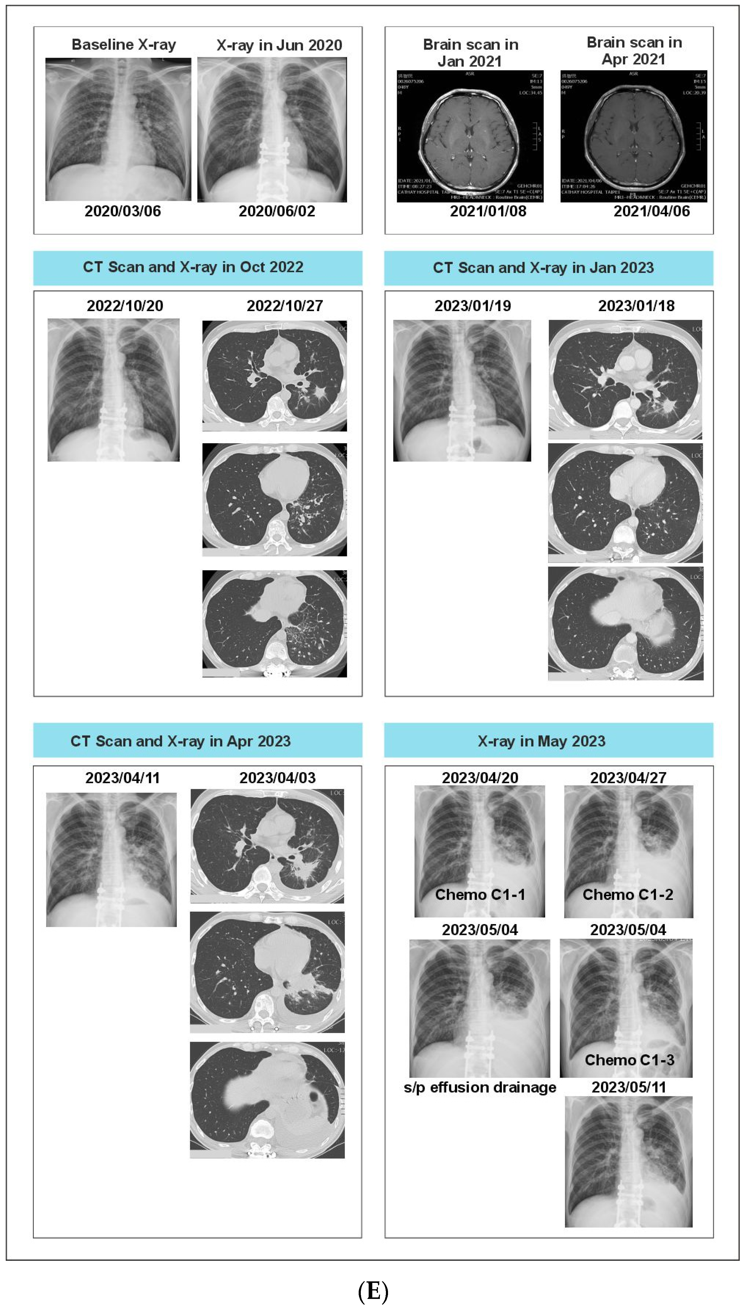 Curroncol 31 00239 g006e