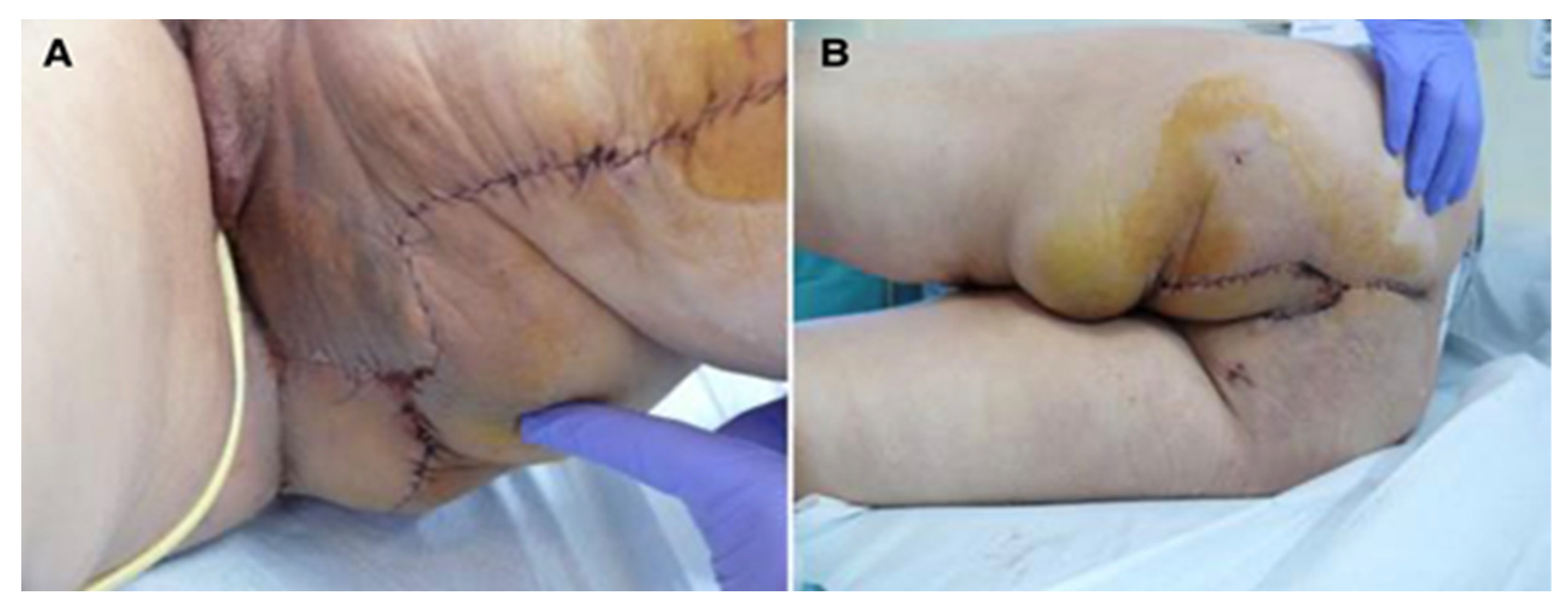 Curroncol 31 00247 g002