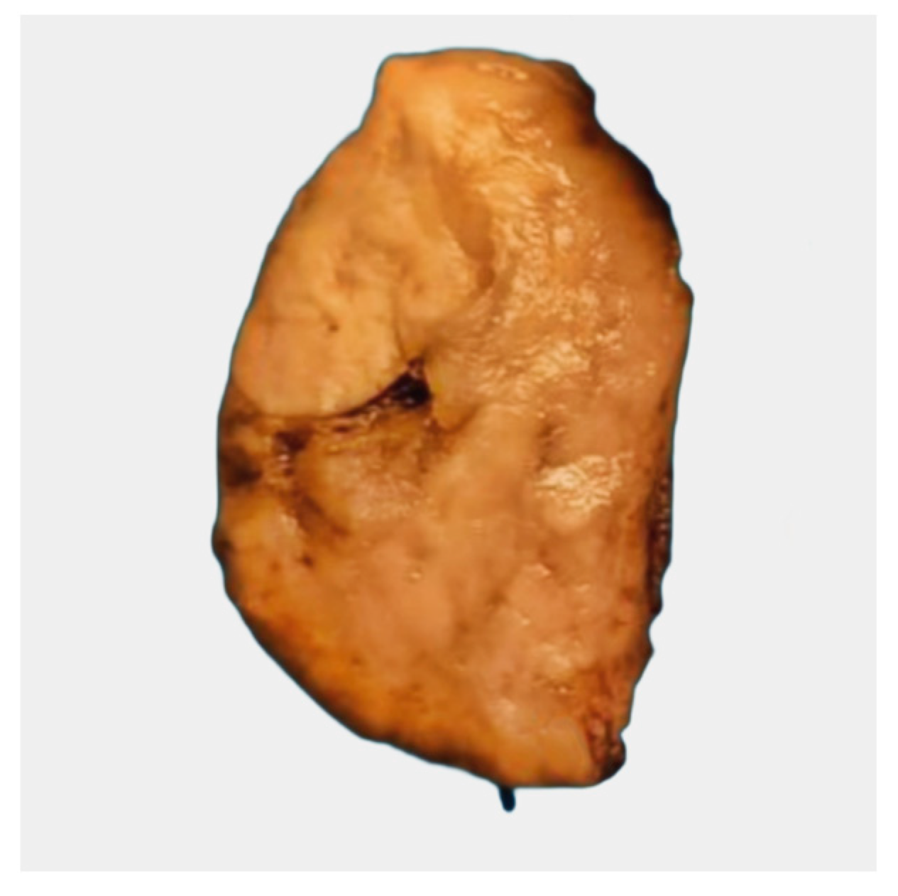 Curroncol 31 00252 g003