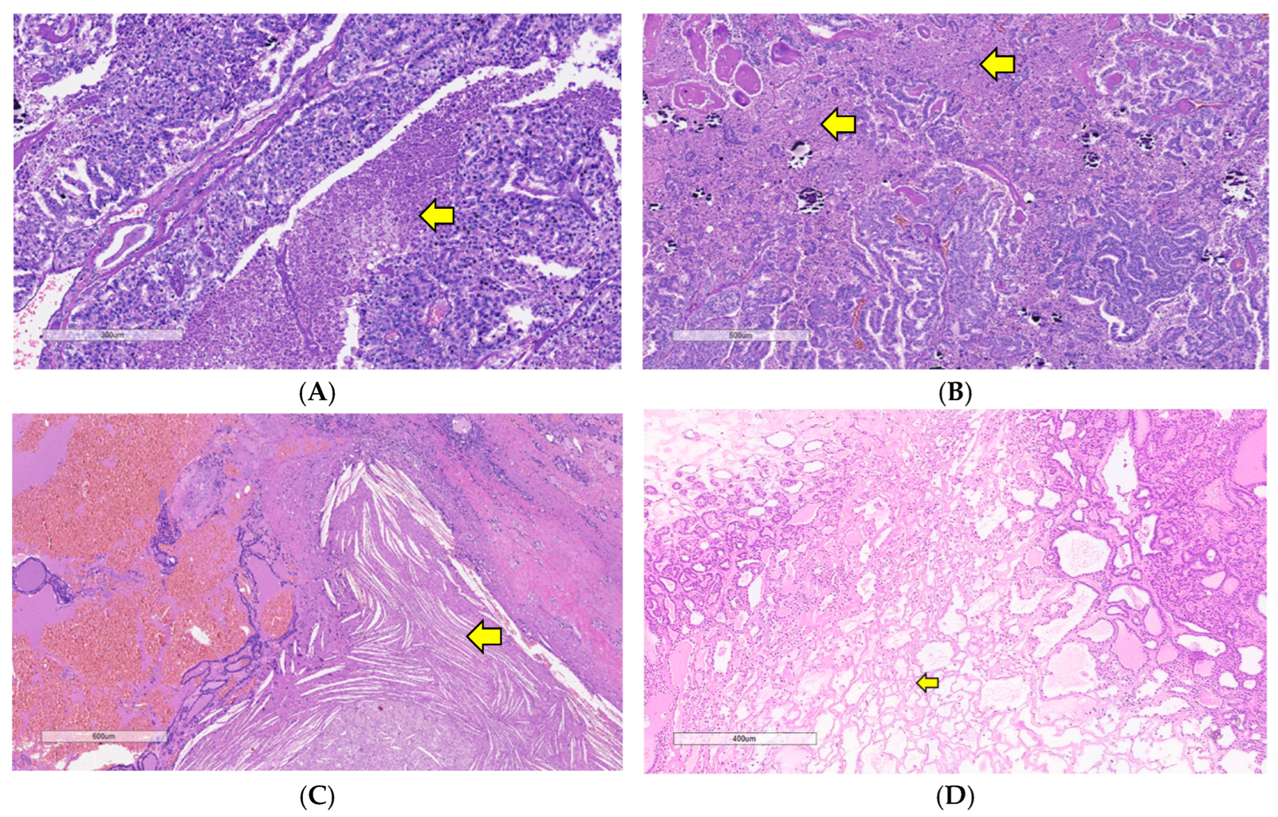 Curroncol 31 00252 g004