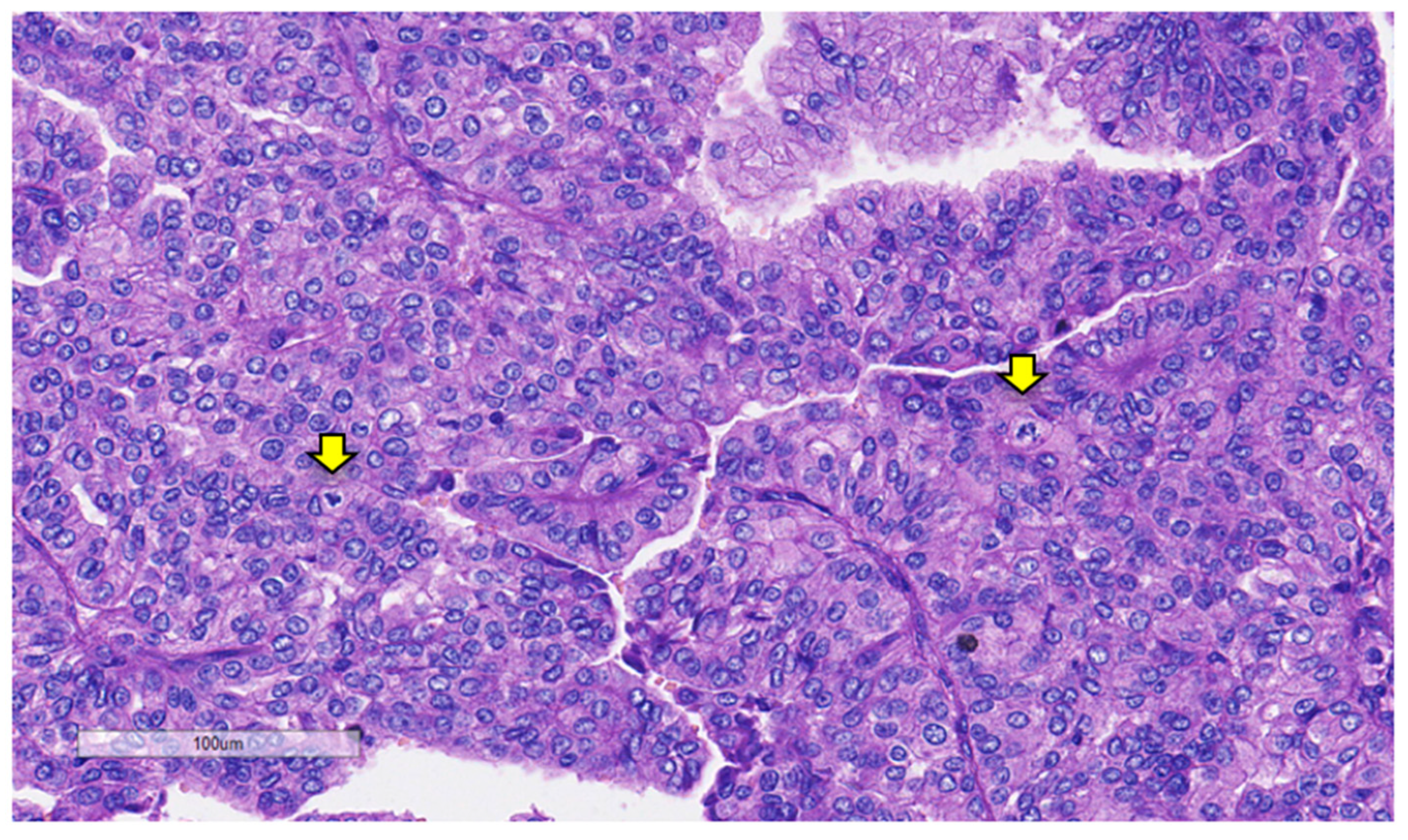 Curroncol 31 00252 g005
