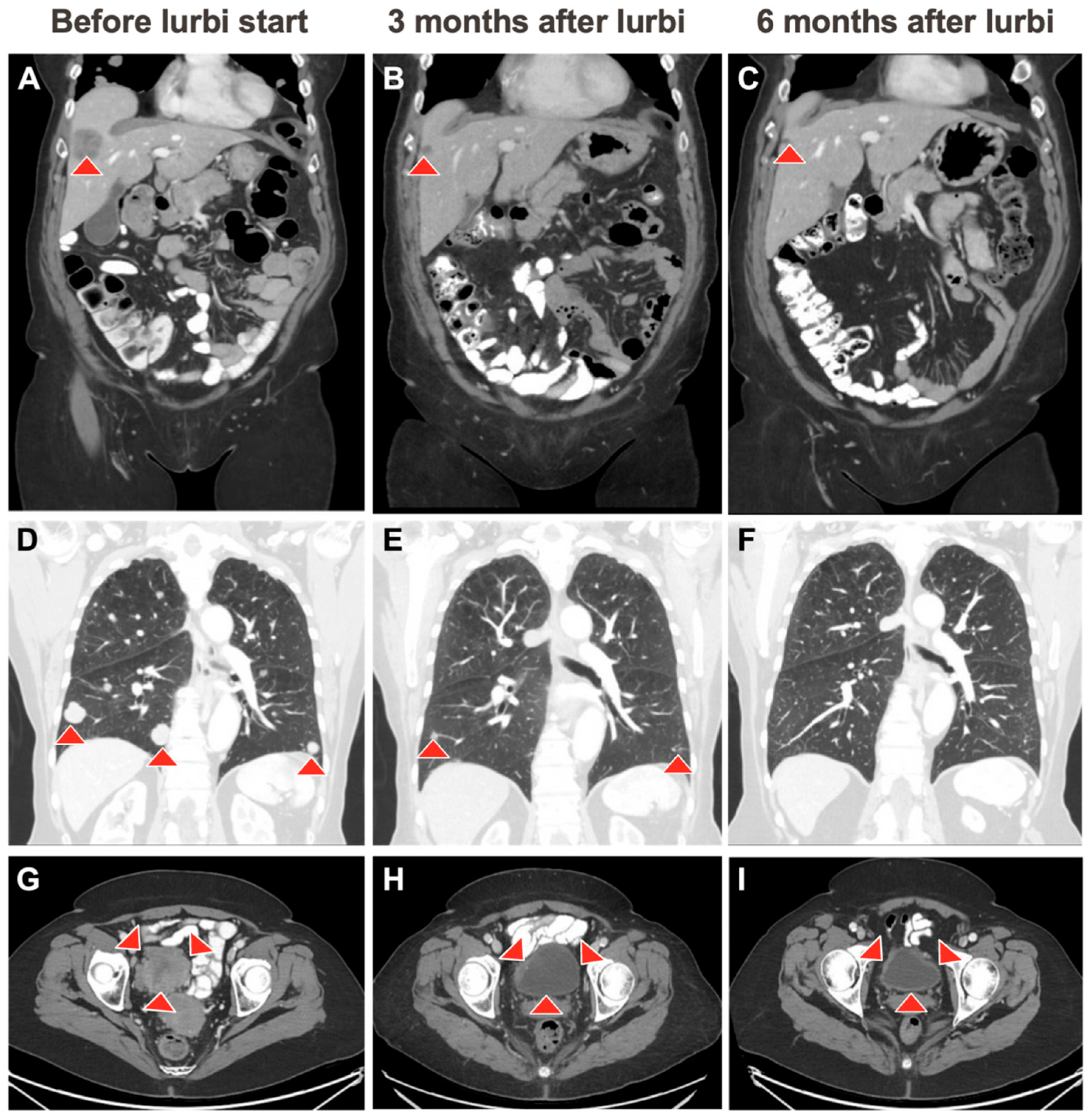 Curroncol 31 00254 g001