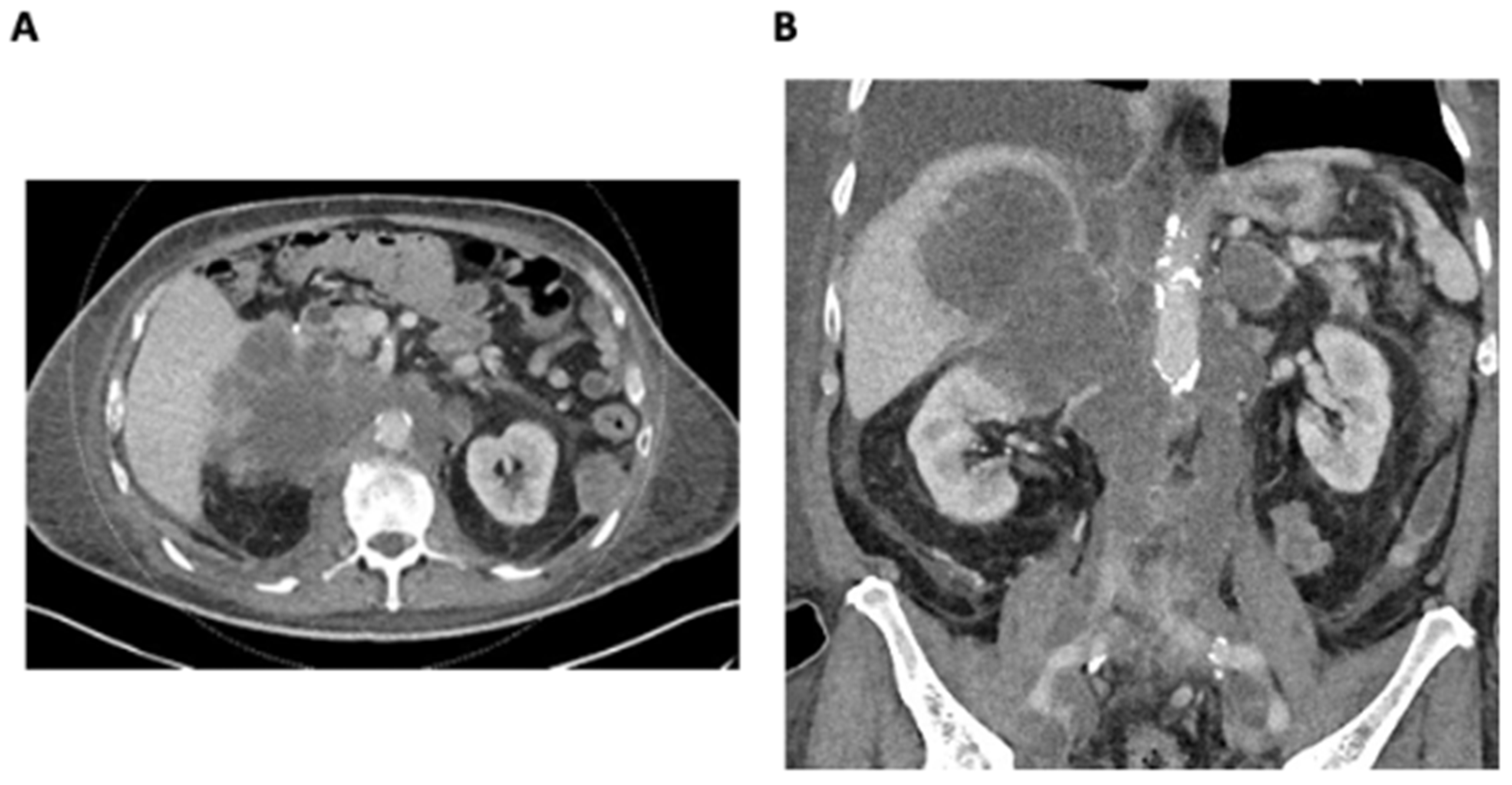Curroncol 31 00294 g001