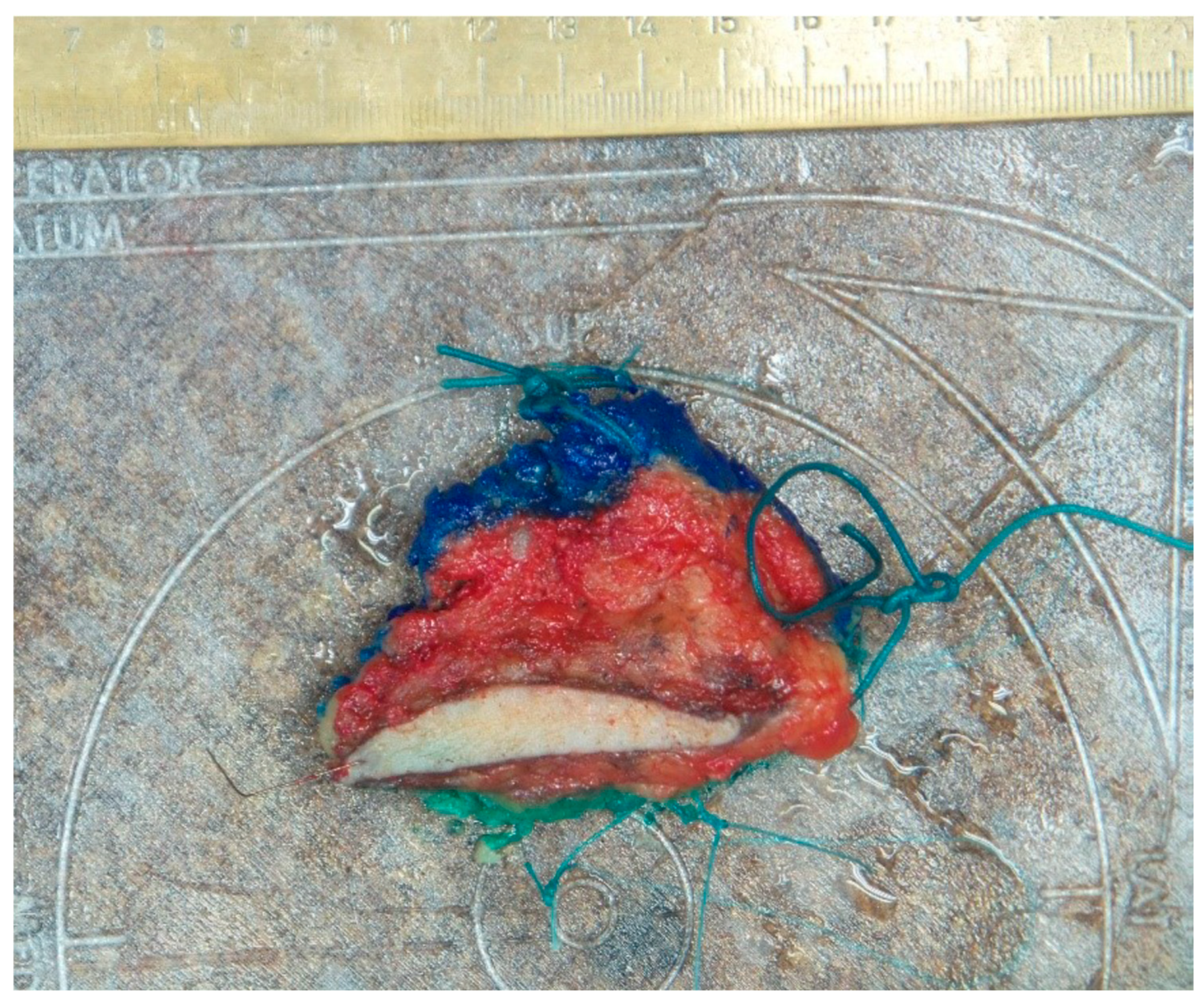 Curroncol 31 00342 g001 Curroncol 31 00342 g001