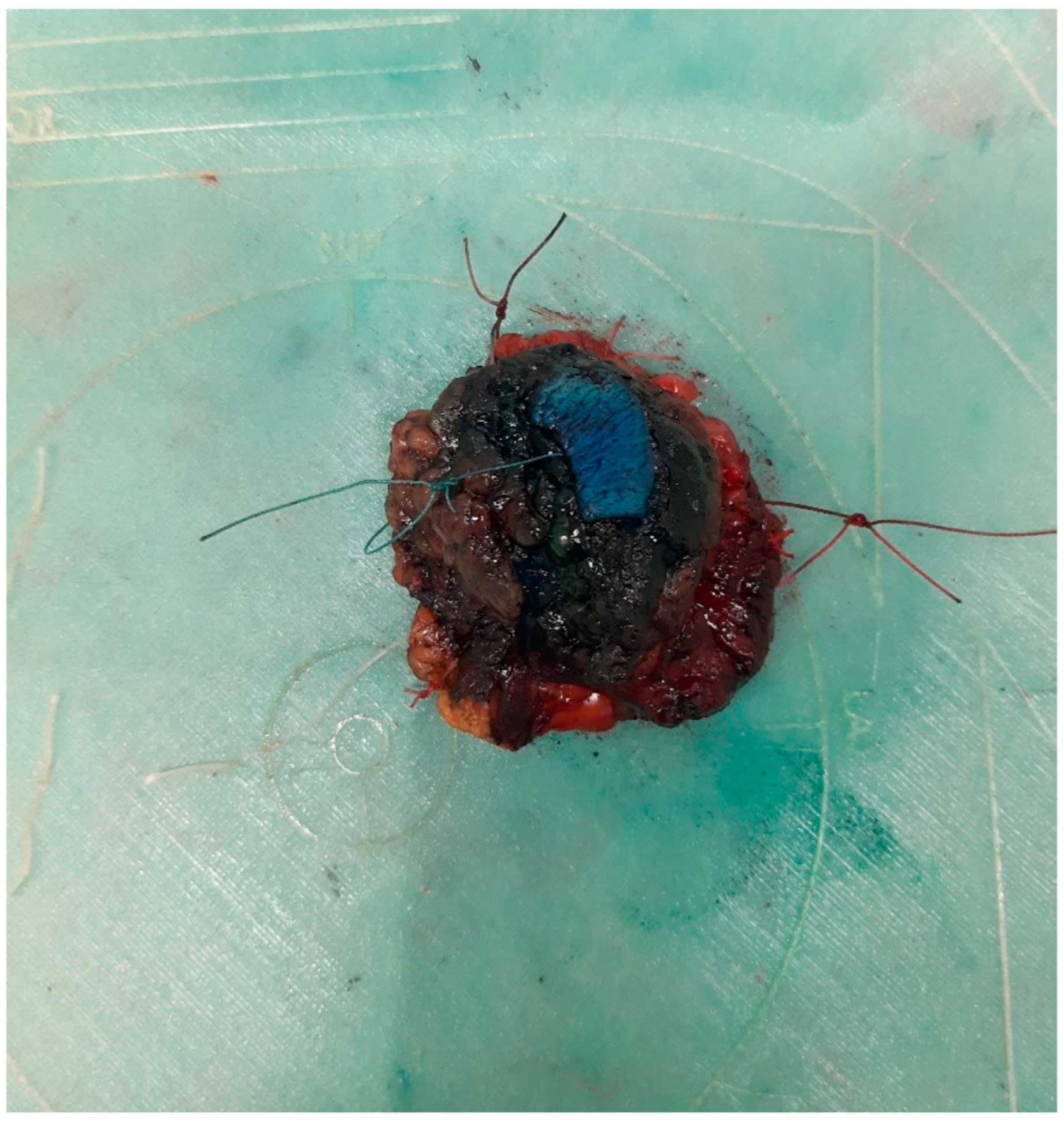 Curroncol 31 00342 g003 Curroncol 31 00342 g003