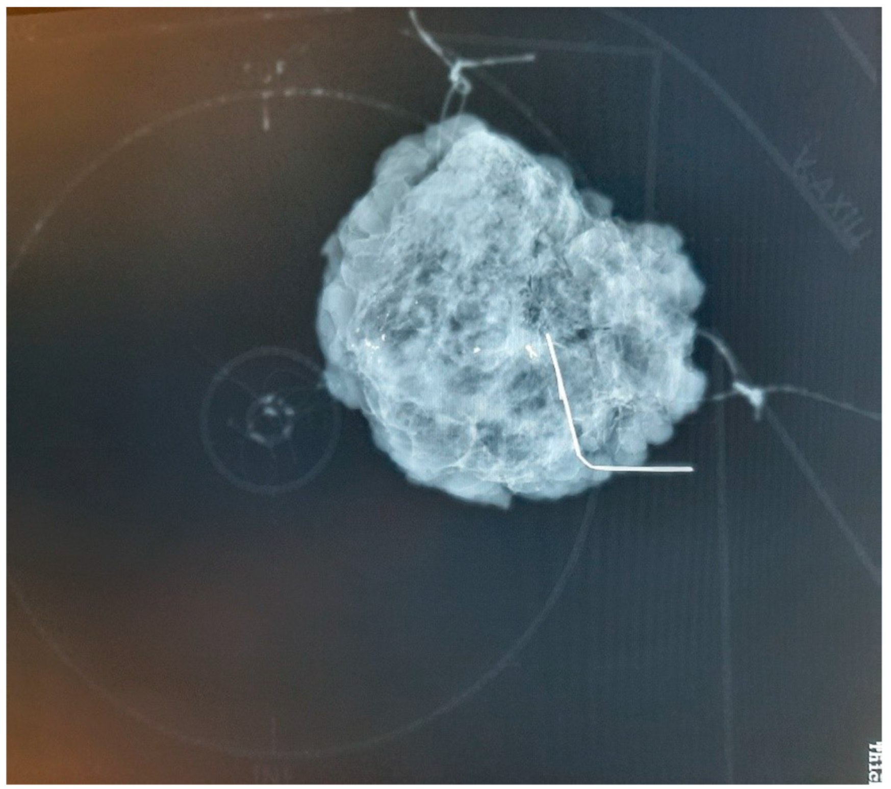 Curroncol 31 00342 g004 Curroncol 31 00342 g004