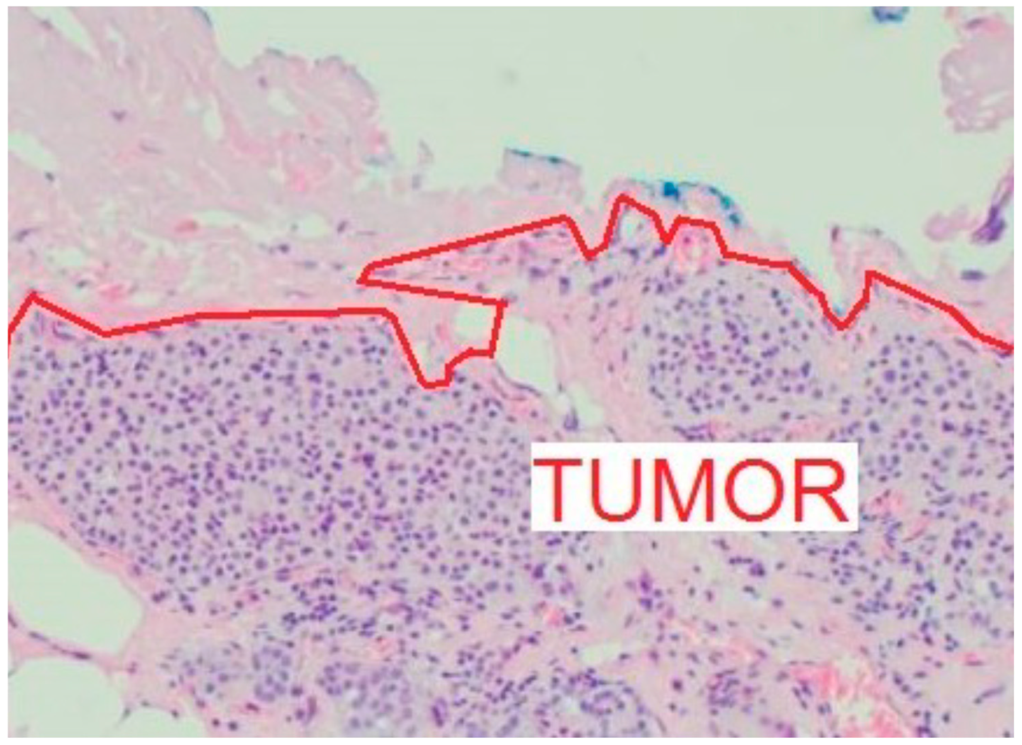 Curroncol 31 00342 g005 Curroncol 31 00342 g005