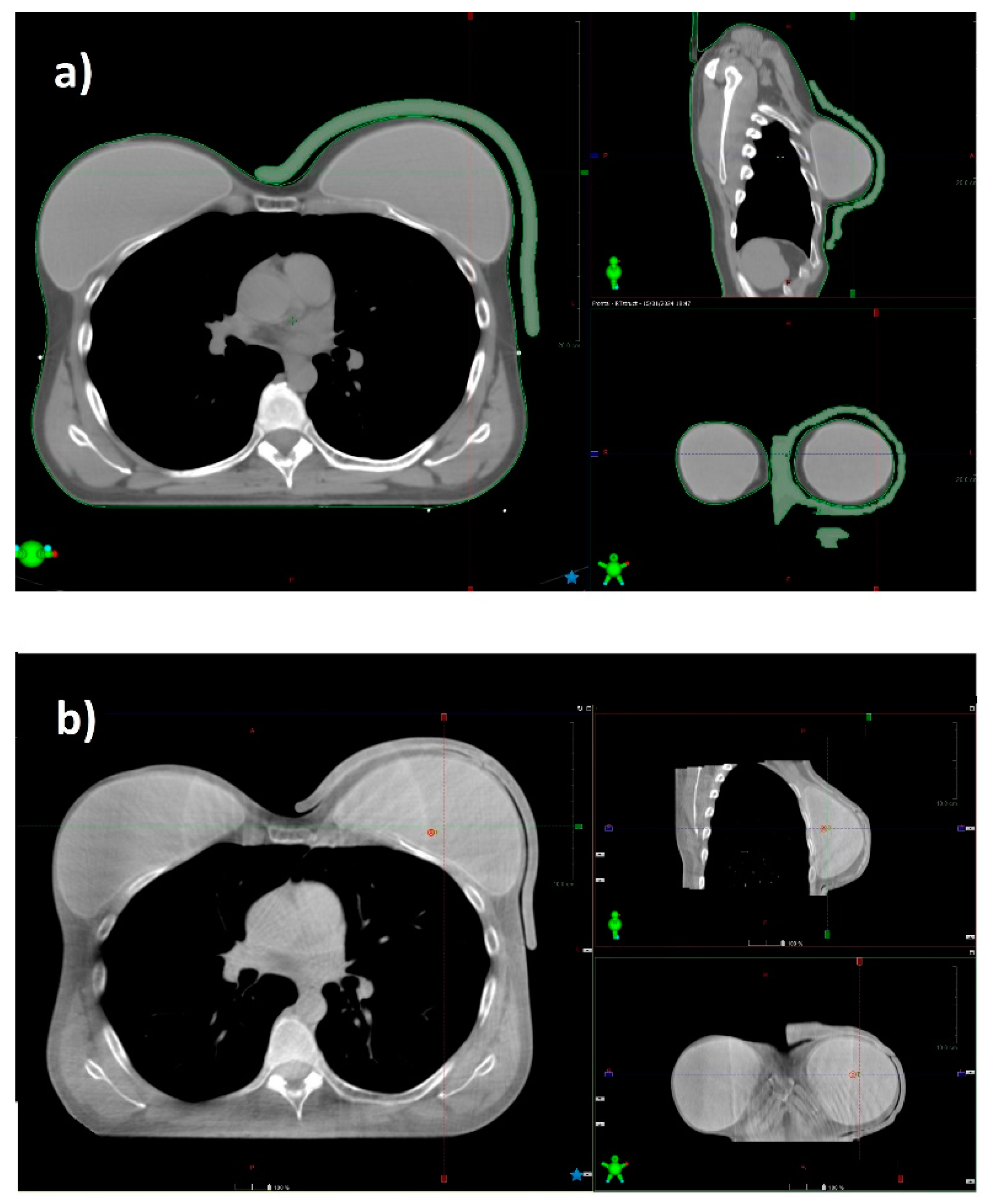 Curroncol 31 00386 g005