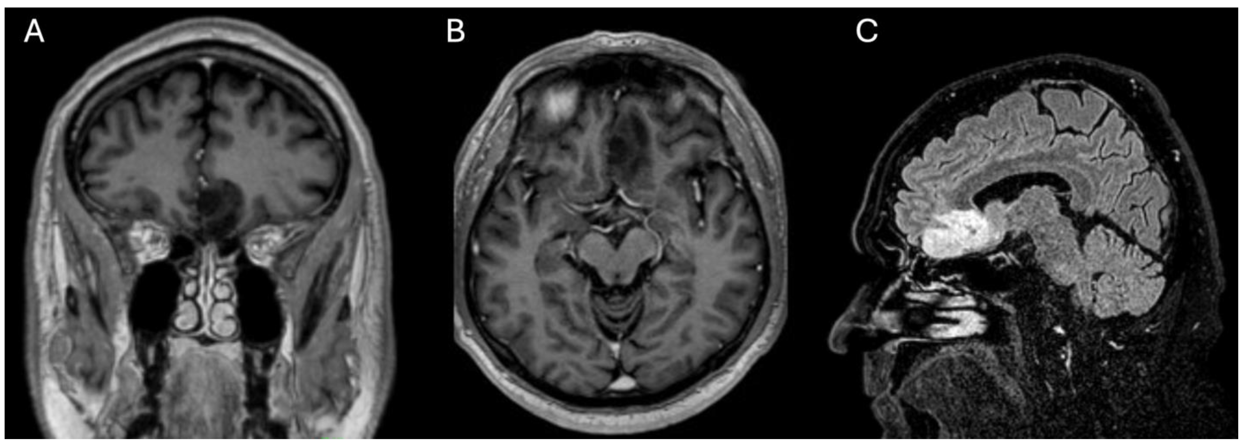 Curroncol 31 00387 g001