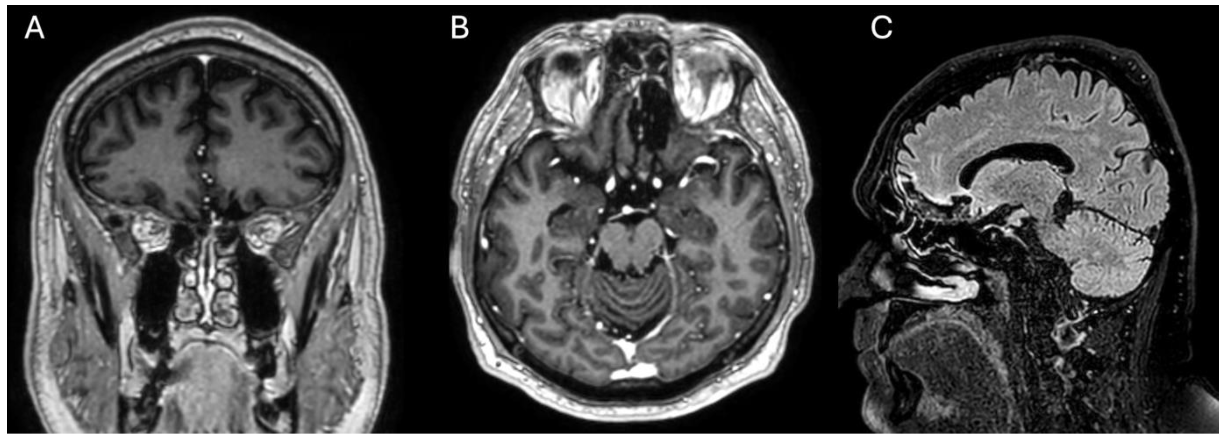 Curroncol 31 00387 g004