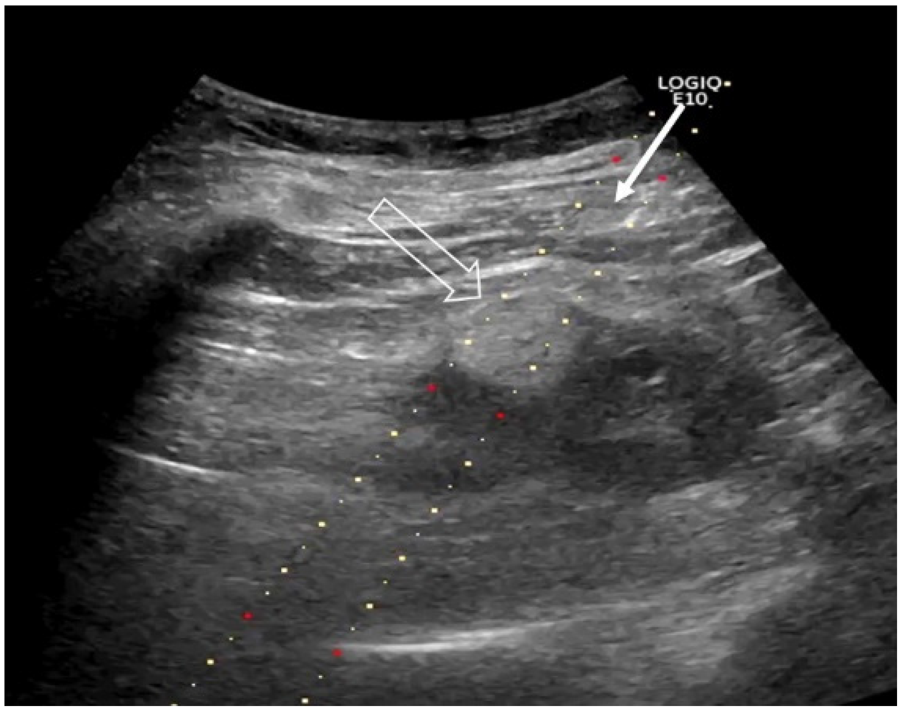 Curroncol 31 00392 g002