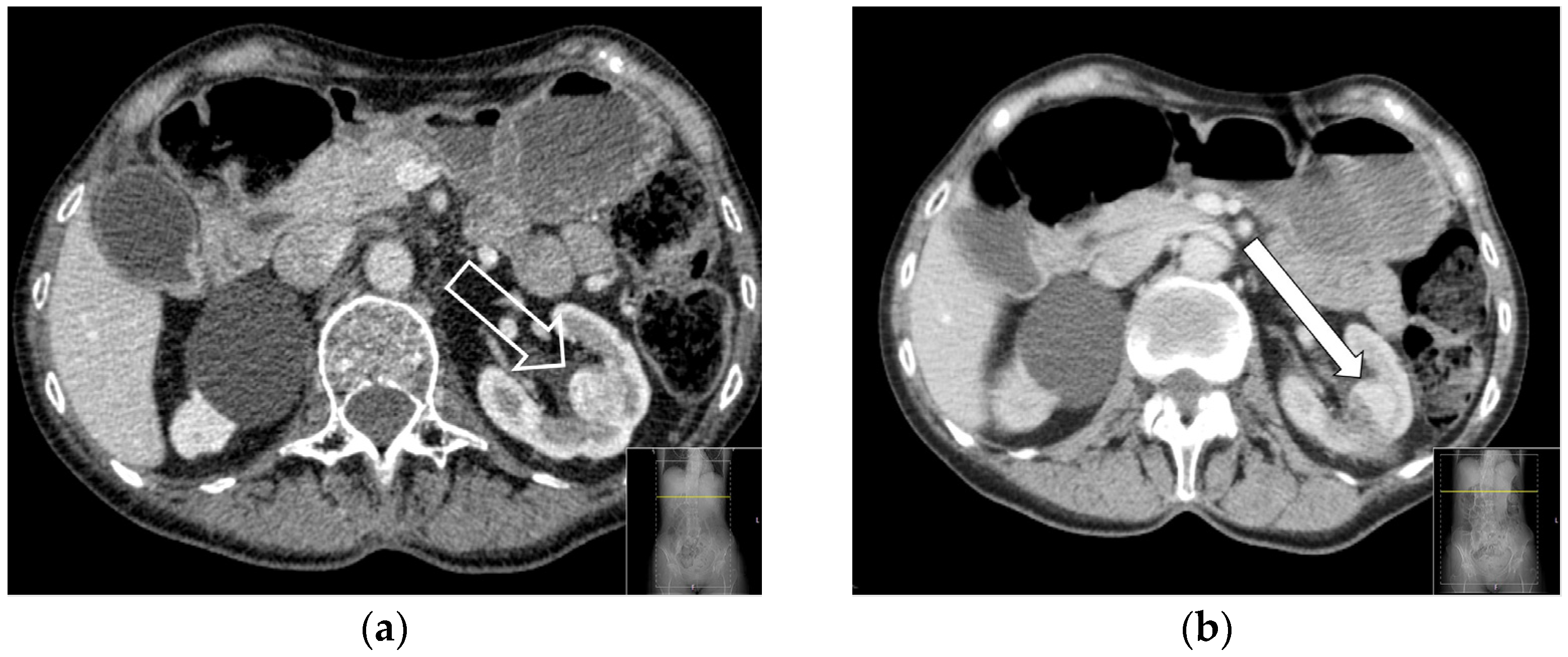 Curroncol 31 00392 g003