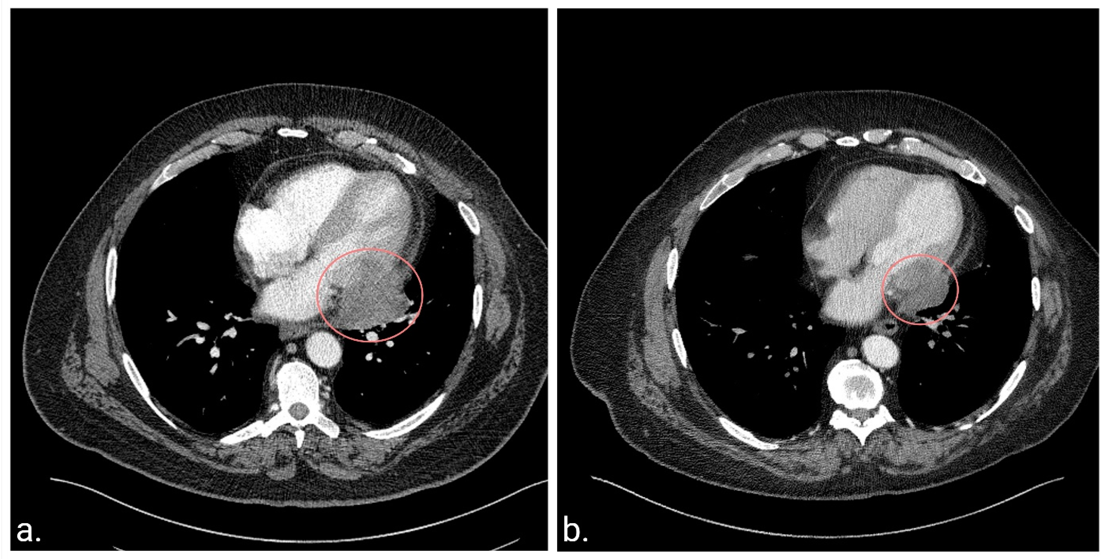Curroncol 31 00398 g001 Curroncol 31 00398 g001