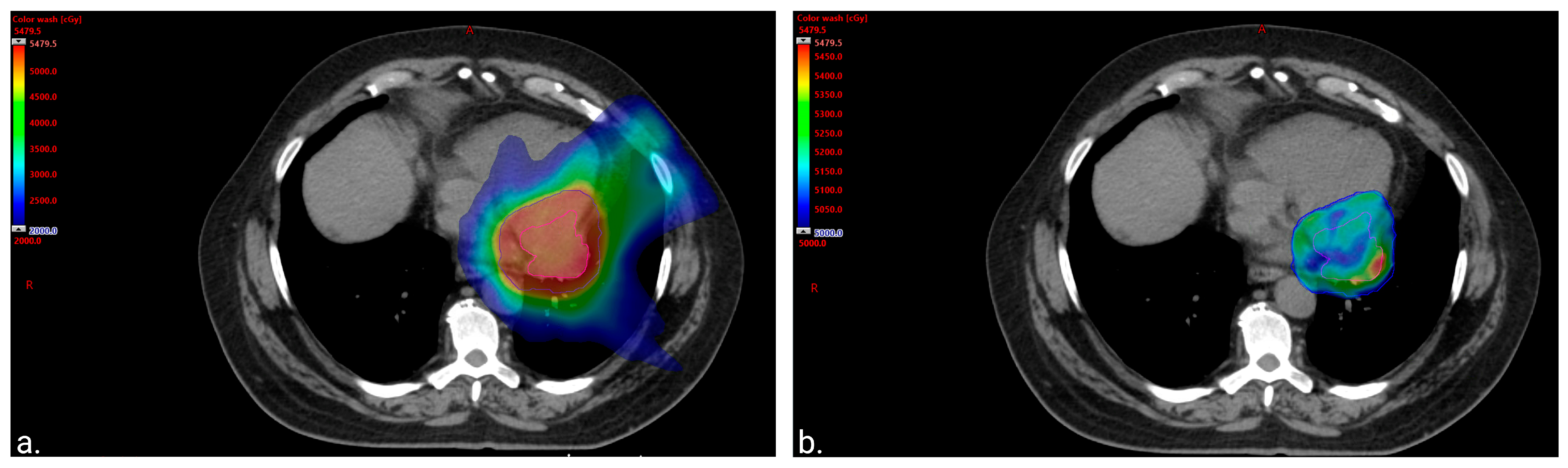 Curroncol 31 00398 g002 Curroncol 31 00398 g002