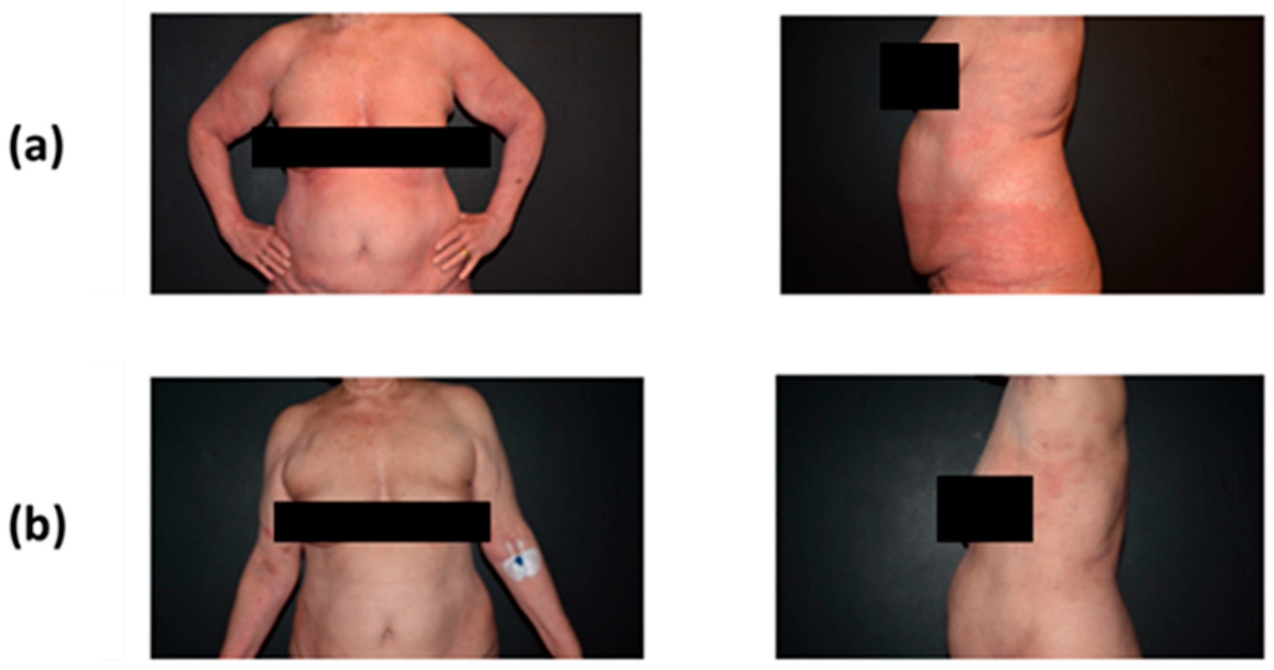 Curroncol 31 00400 g002