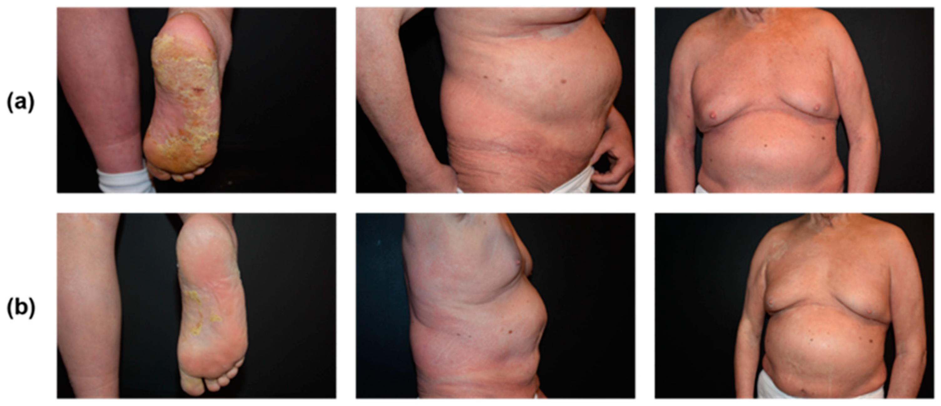 Curroncol 31 00400 g004