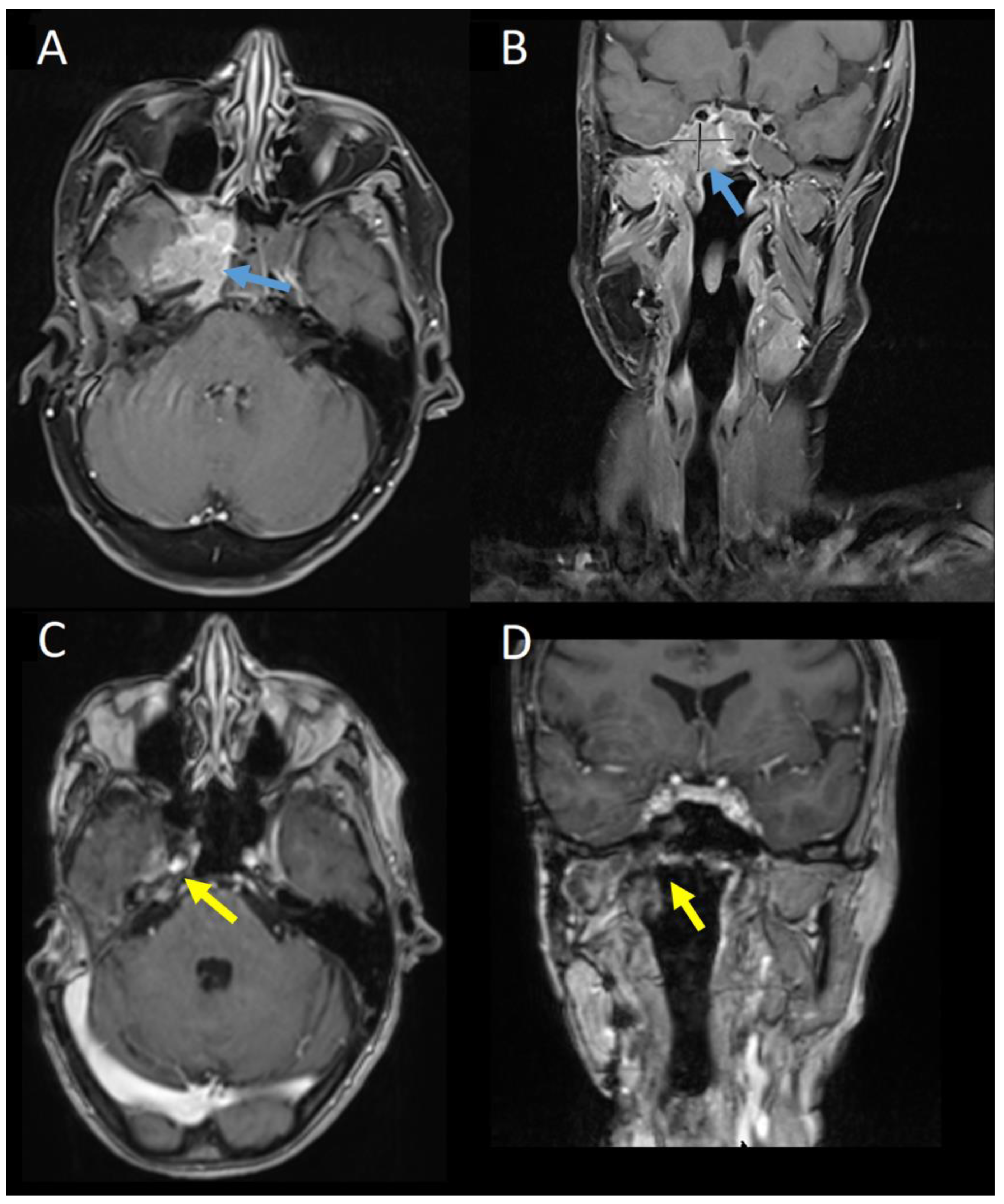 Curroncol 31 00419 g003