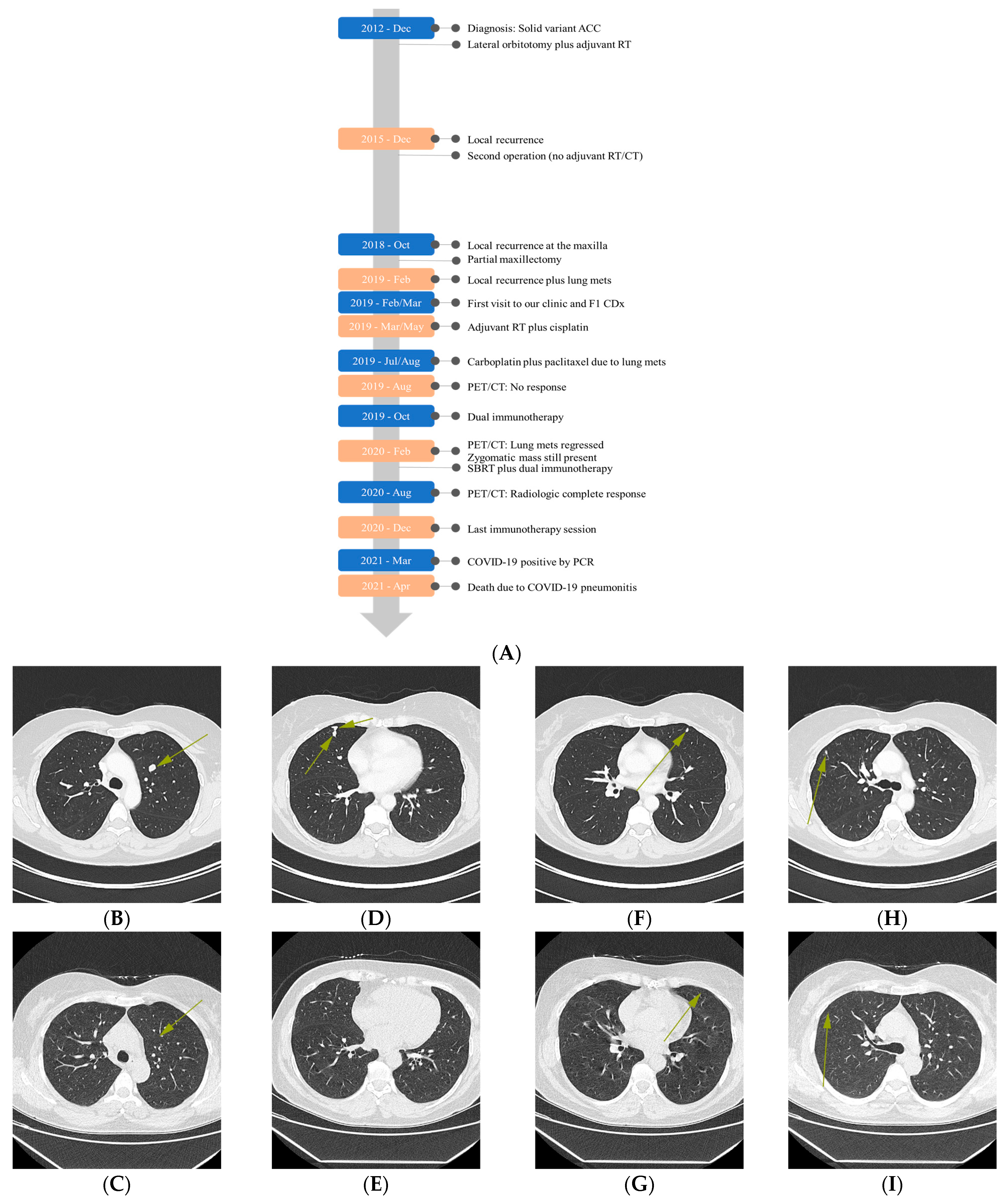 レビュー高評価の商品 Personalized Immunotherapy Achieves Complete Response in 応援グッズ