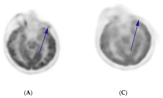 oct様 Secto Design（セクト デザイン）Octo 4240 ペンダントランプ