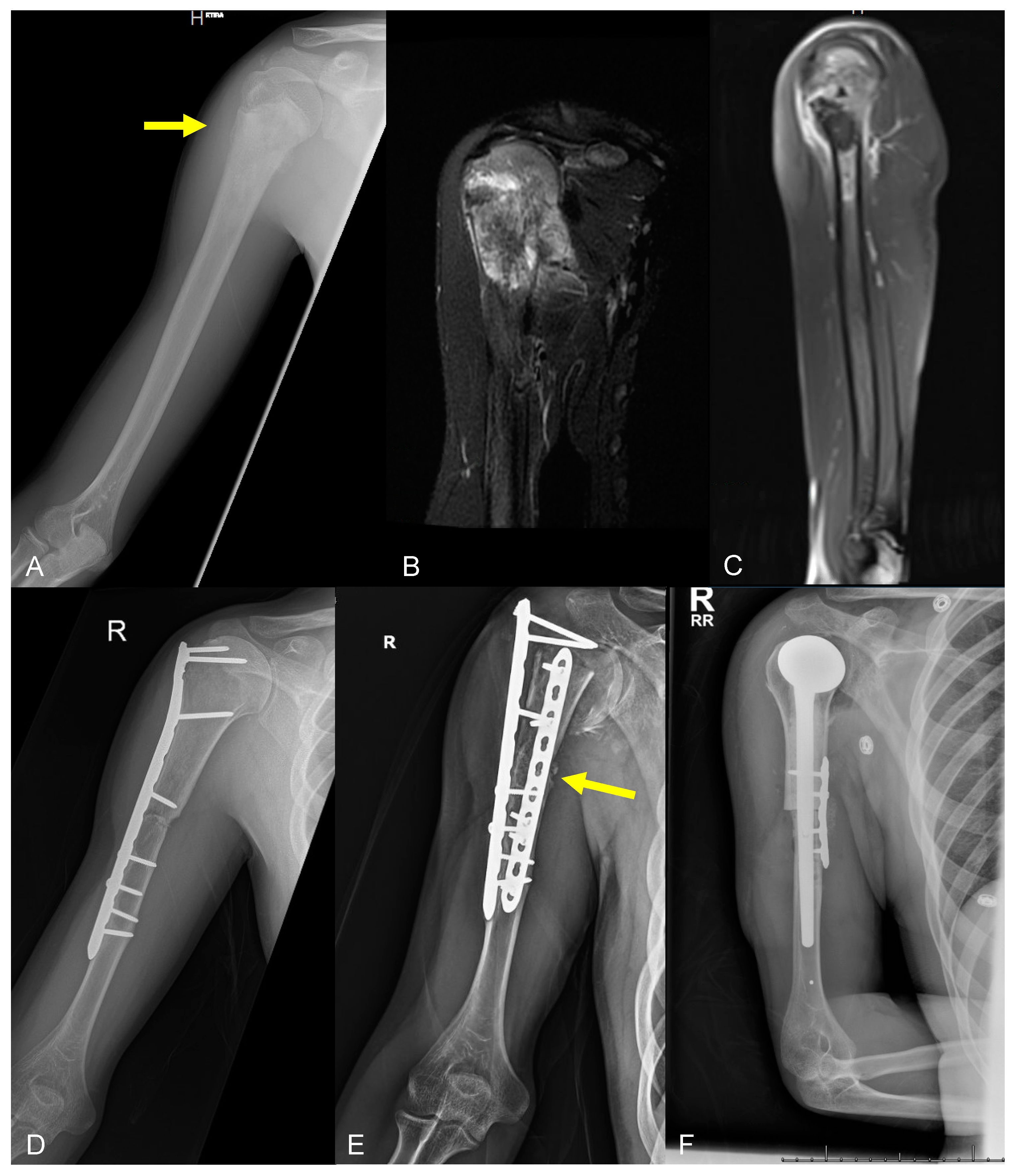 Curroncol 31 00465 g006